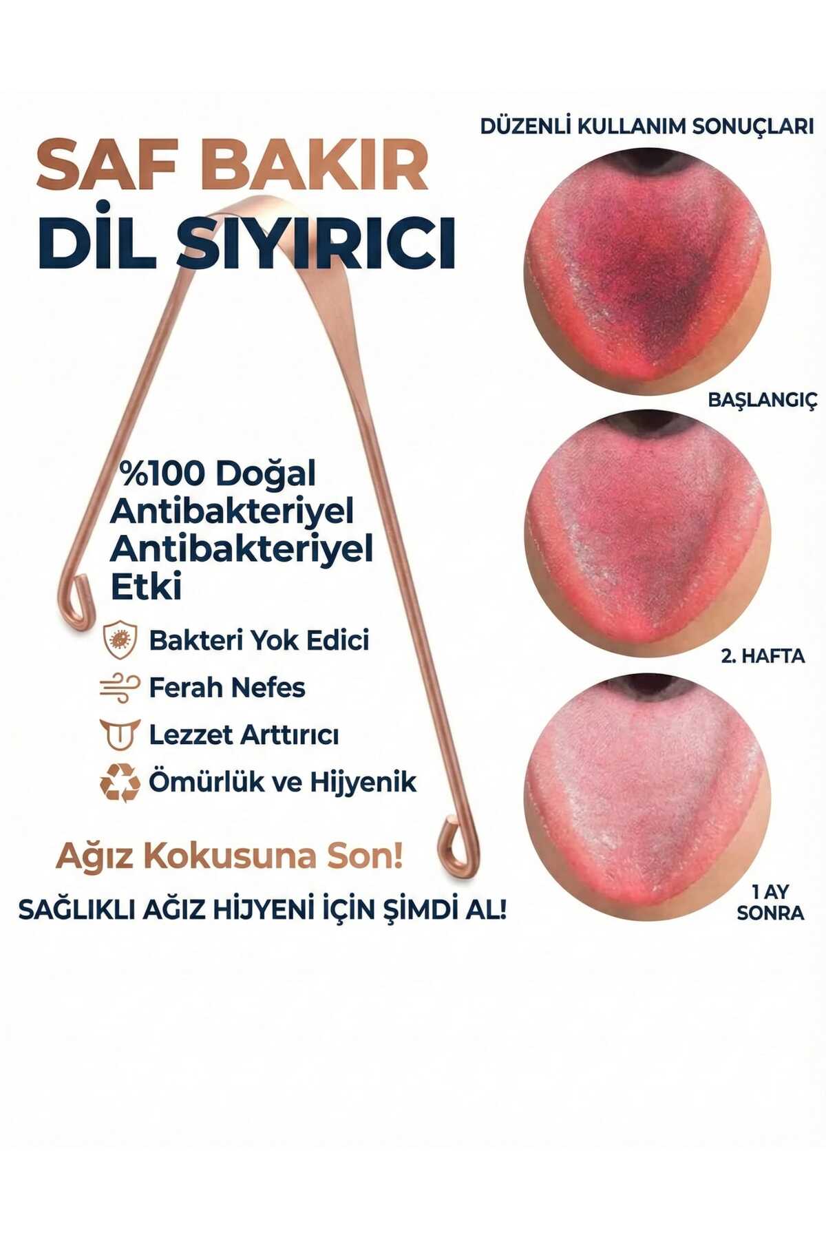 LOVYCO Dil Temizleme %100 Saf Bakır Temizlik Aleti Dil Fırçası Dil Kaşığı,dil Sıyırıcı - Fiyatı, Yorumları