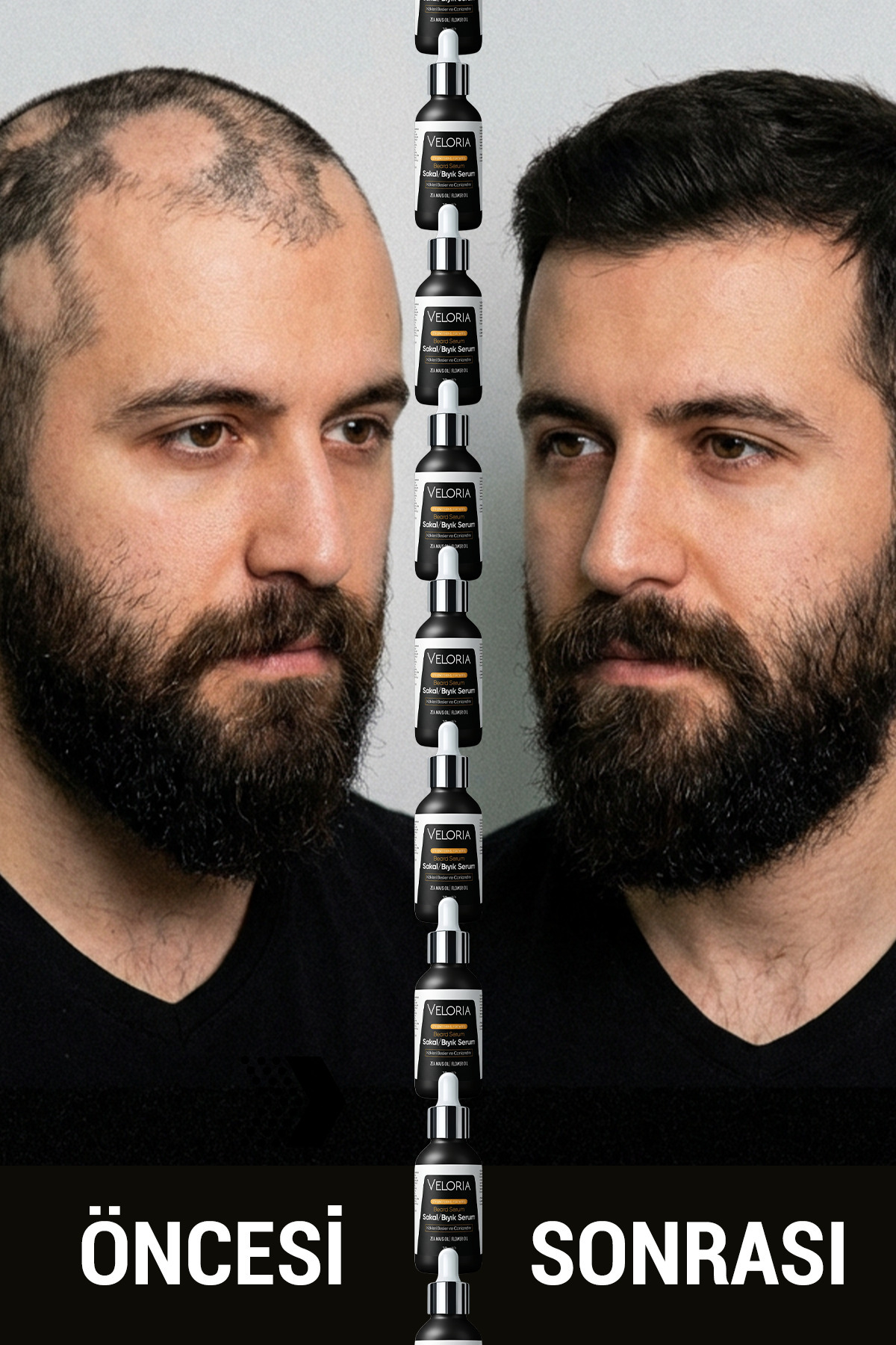 Canlılığın ve Gücün~Iksiri Saç & Sakal Serumu Seyrek Bölgelere~son 30ml — velorıa4747 — تصویر 6 از 6