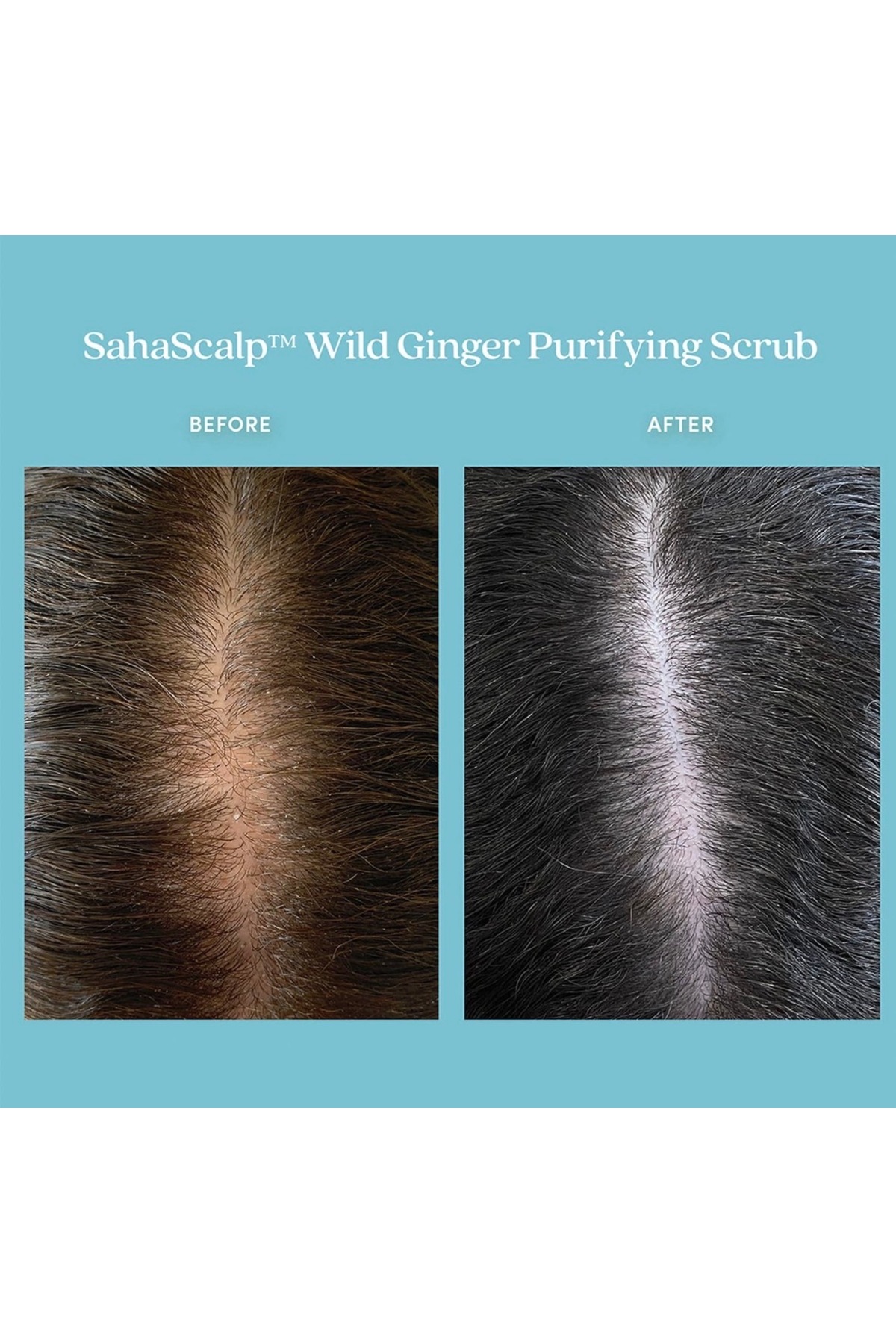 اسکراب پاک کننده موی زنجبیل وحشی SahaScalp 237 میلی لیتر Elsbeauty — elsbeautyhairmask818372 — تصویر 2 از 3