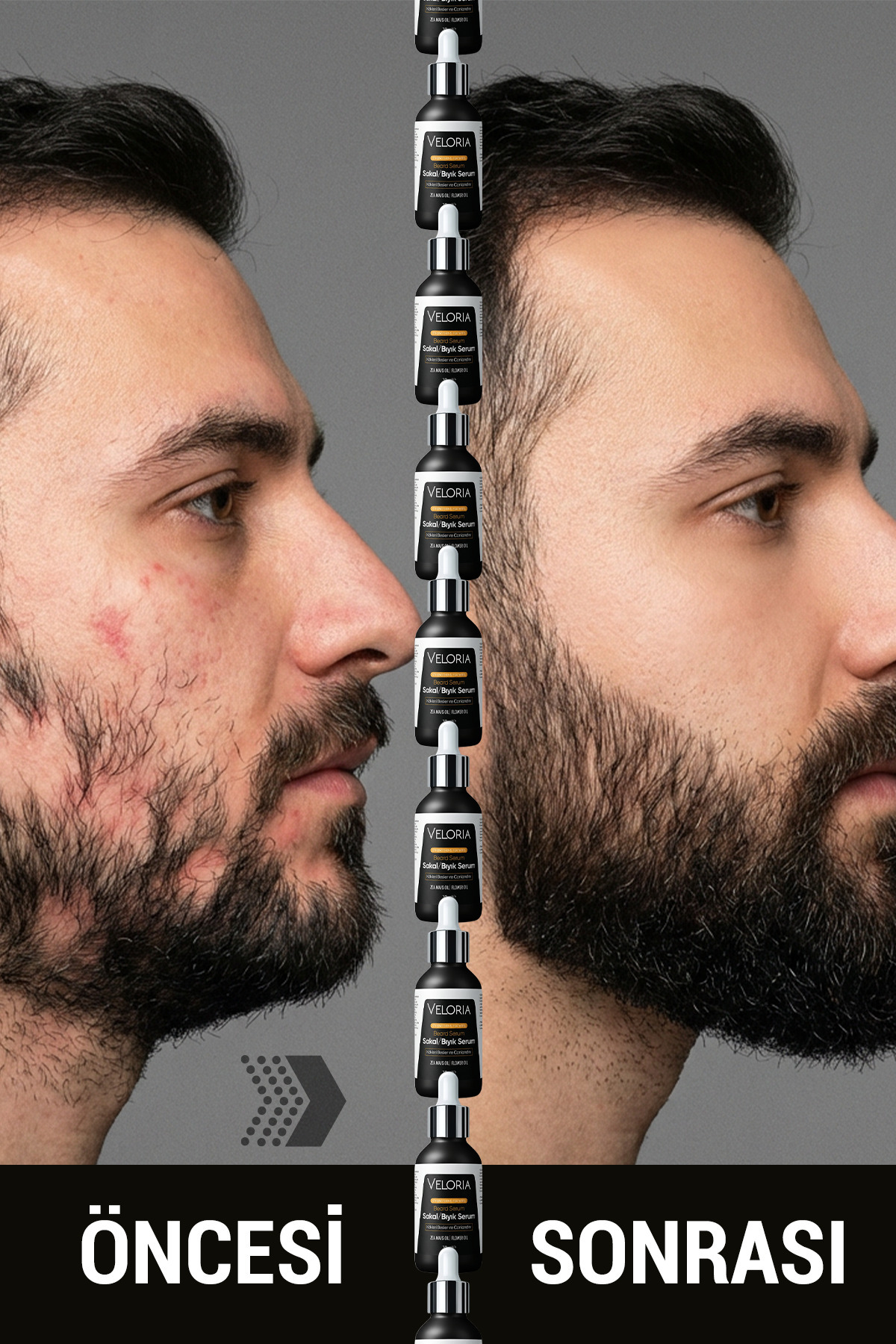 Canlılığın ve Gücün~Iksiri Saç & Sakal Serumu Seyrek Bölgelere~son 30ml — velorıa4747 — تصویر 5 از 6