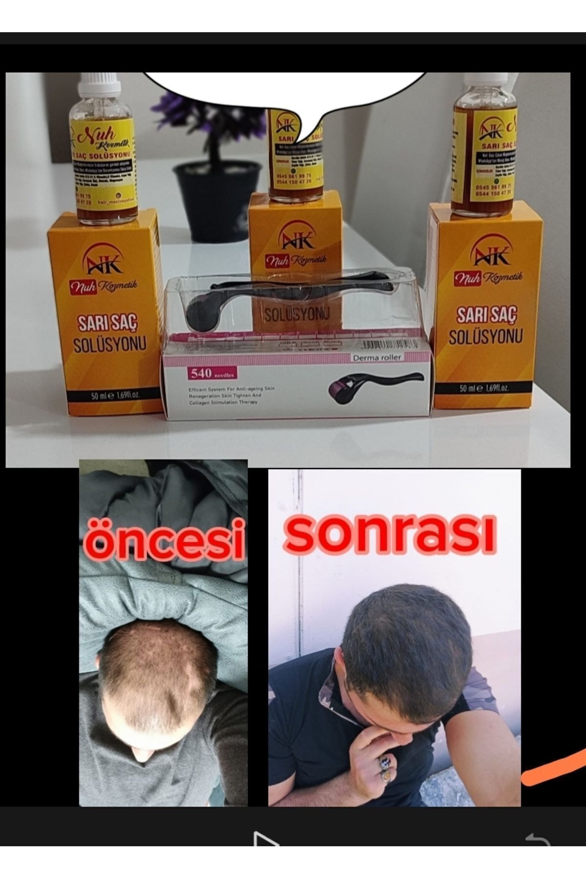 Sarı saç solusyonu — 5011380547 — تصویر 3 از 8