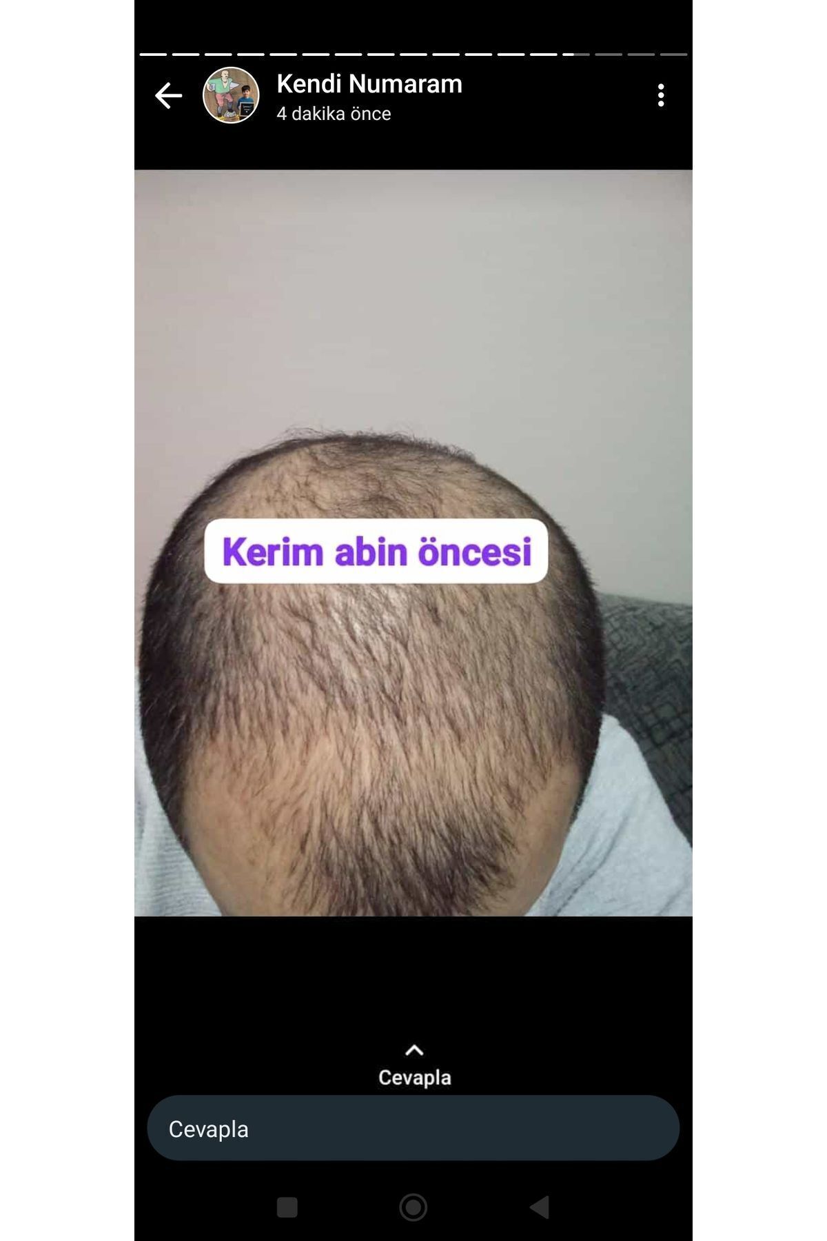 Sarı saç solusyonu — 5011380547 — تصویر 6 از 8