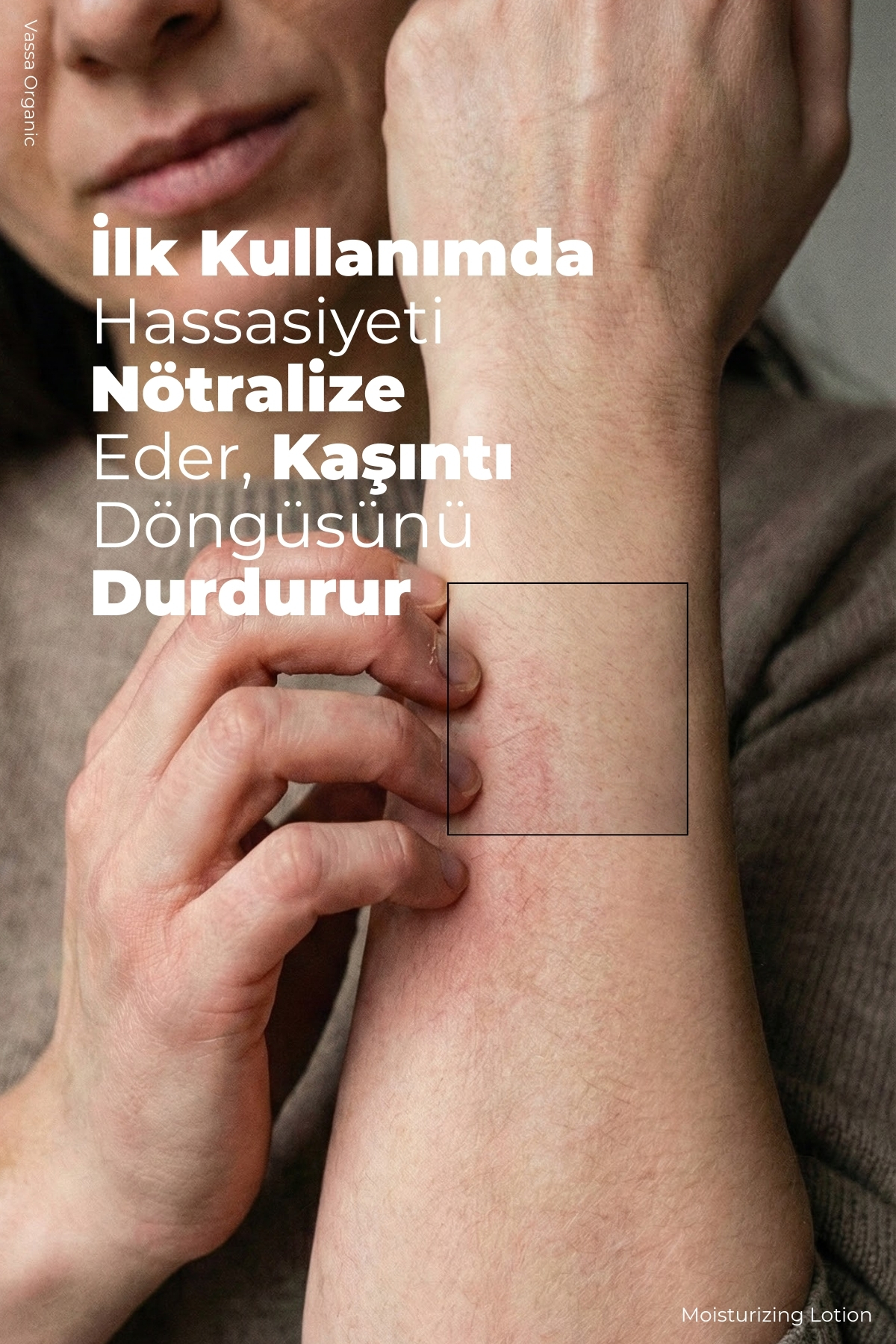 Kaşıntı Karşıtı, Pul Pul Dökülme Azaltıcı, Cilt Bakım Kremi - Yoğun Vücut Nemlendiricisi 100 ml — VASSA0021VBK — تصویر 3 از 7