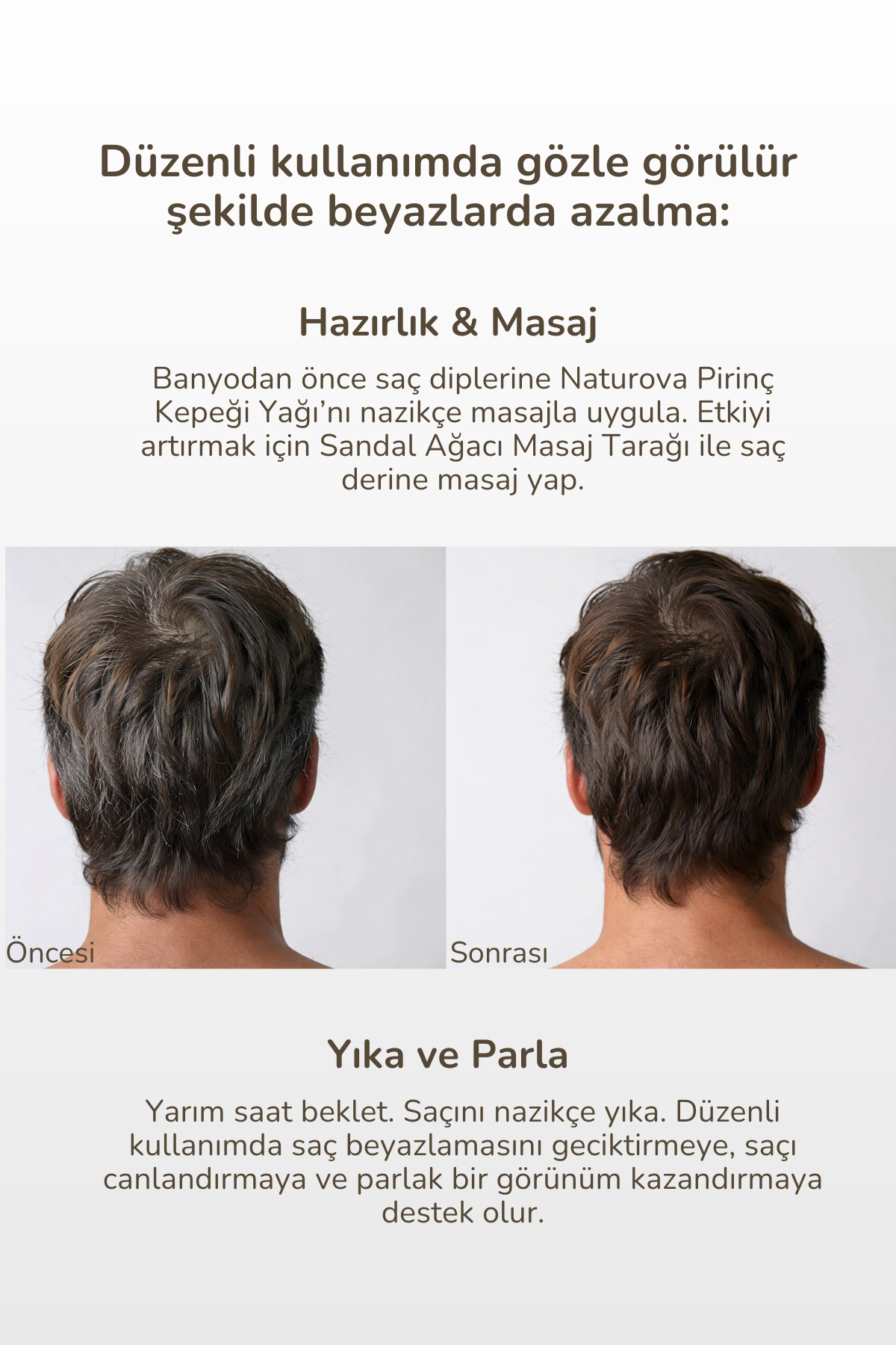 Pirinç Kepeği Yağı Soğuk Sıkım % 100 Saf 30 ml — TYCJ0NL3GN170367536311287 — تصویر 4 از 5