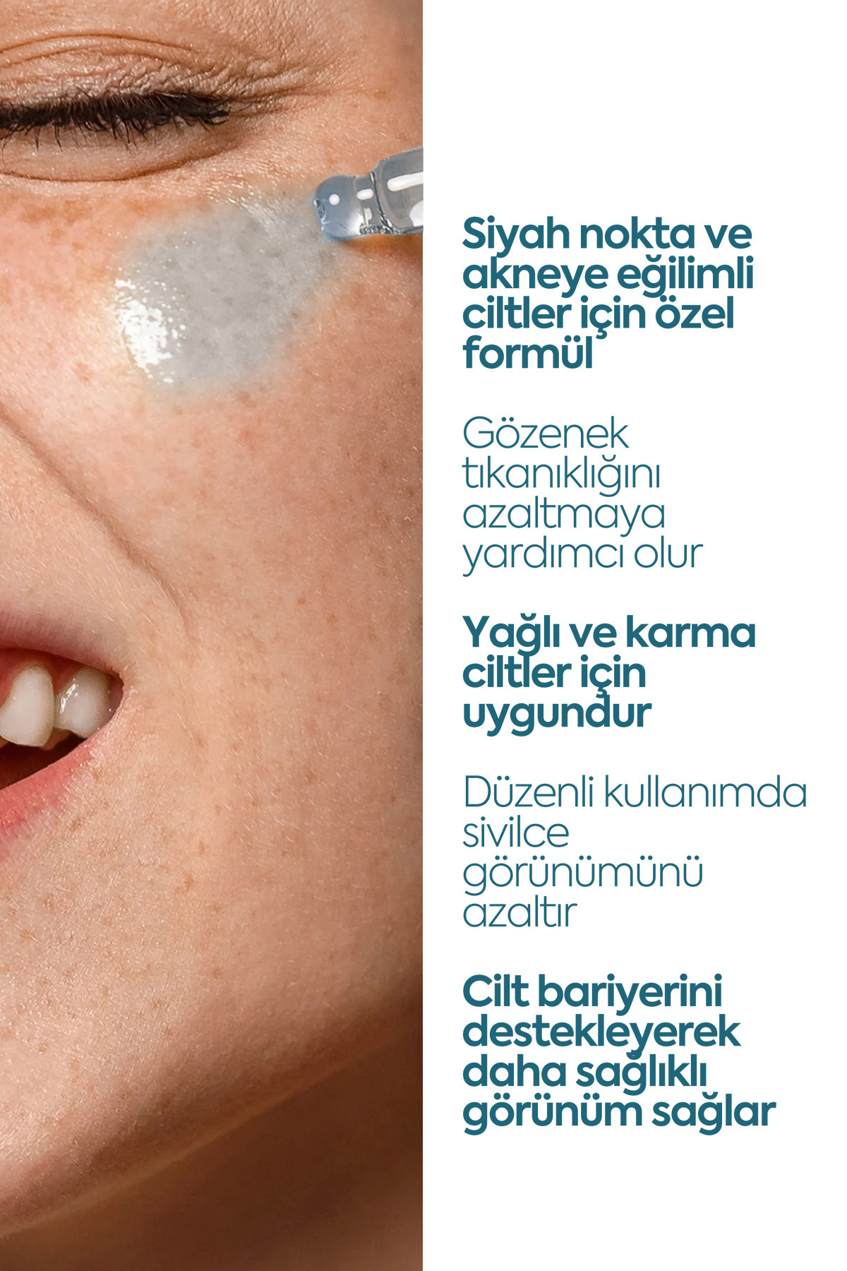 Siyah Nokta Ve Karşıtı, Önleyici Serum, Niasinamid Ve Çinko — akne serum — تصویر 3 از 8