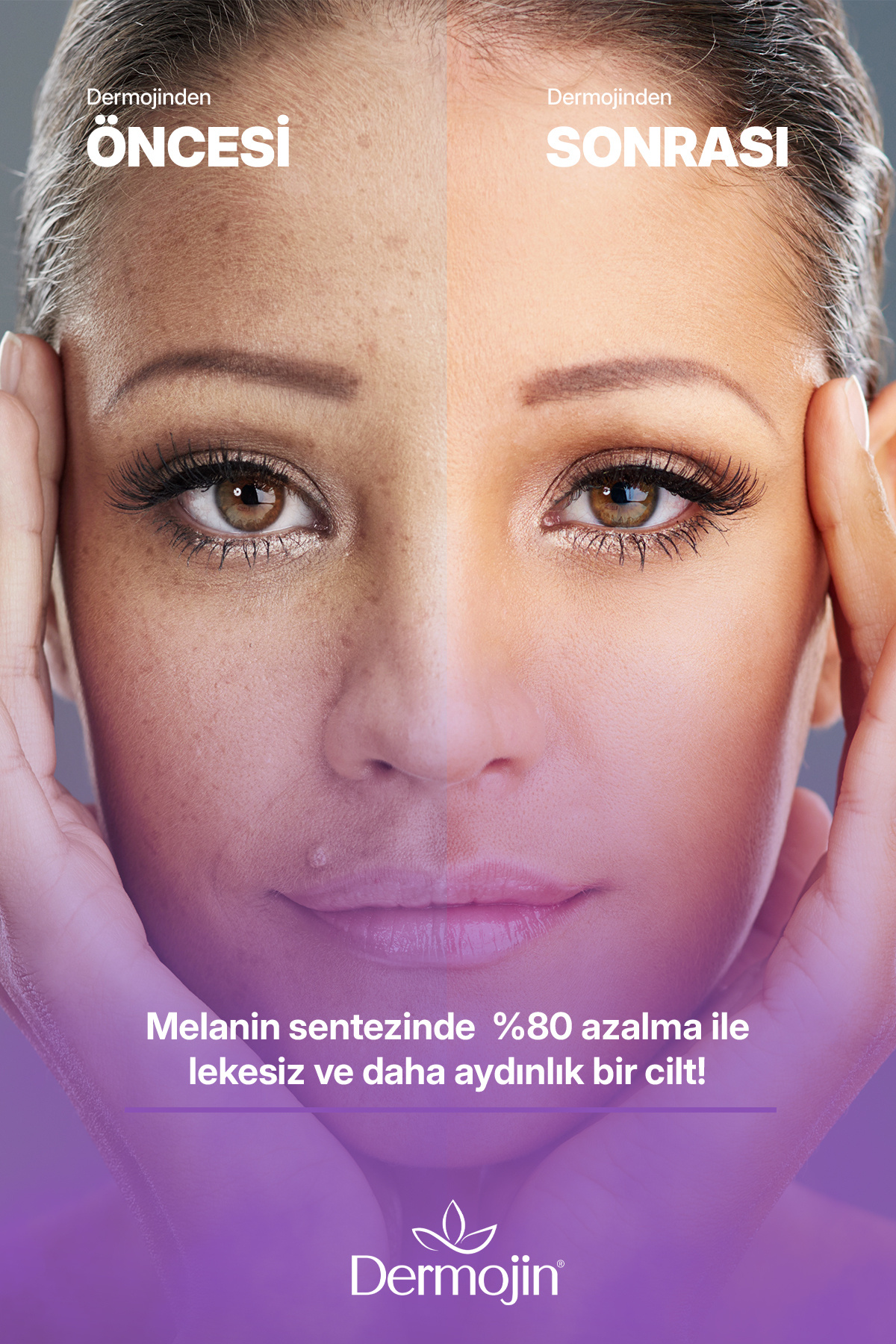 Leke Karşıtı Ve Aydınlatıcı Cilt Bakım Serumu 30 ml — DLKCBS100 — تصویر 4 از 5