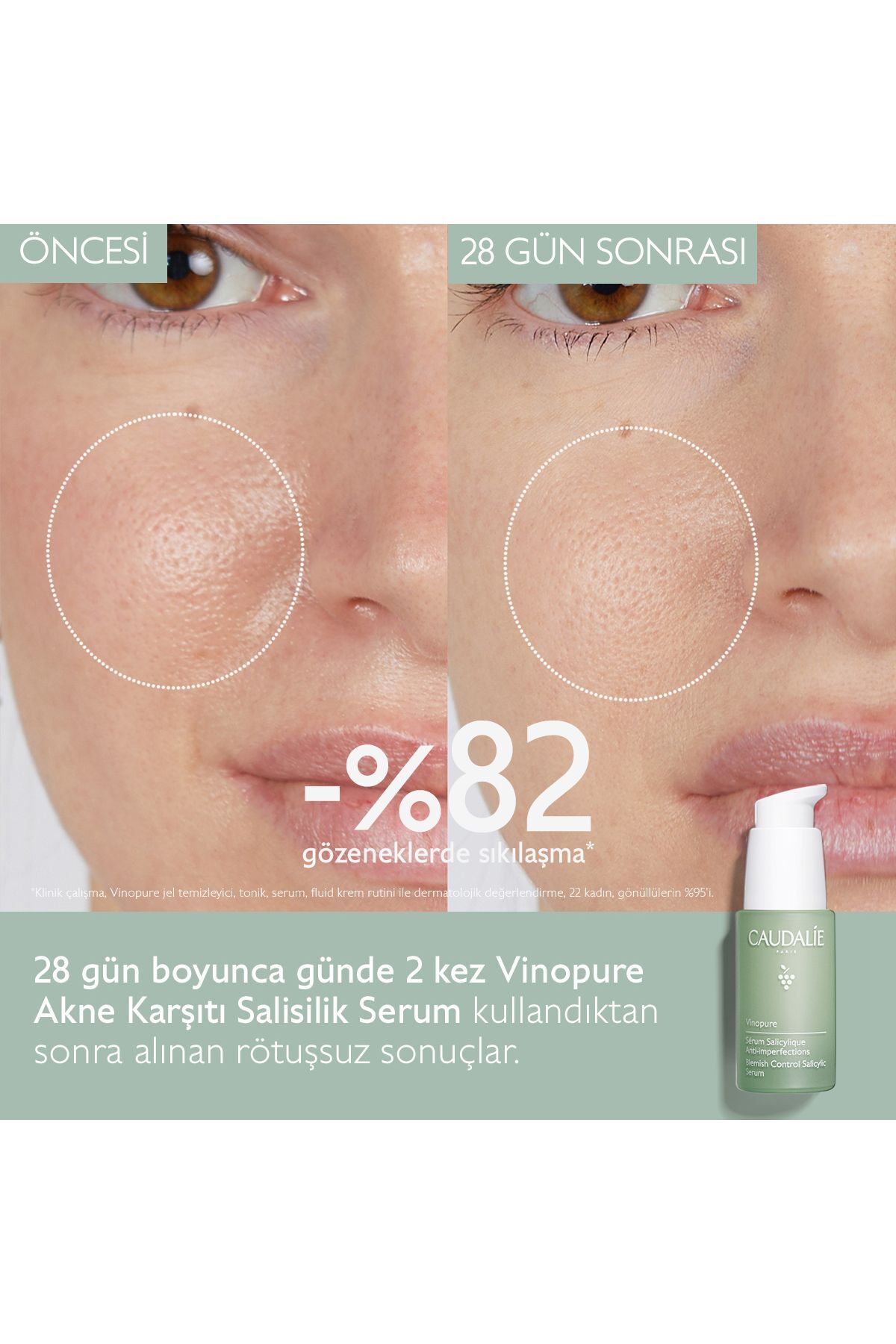 Vinopure Salisilik Serum 30 ml — 344 — تصویر 4 از 7