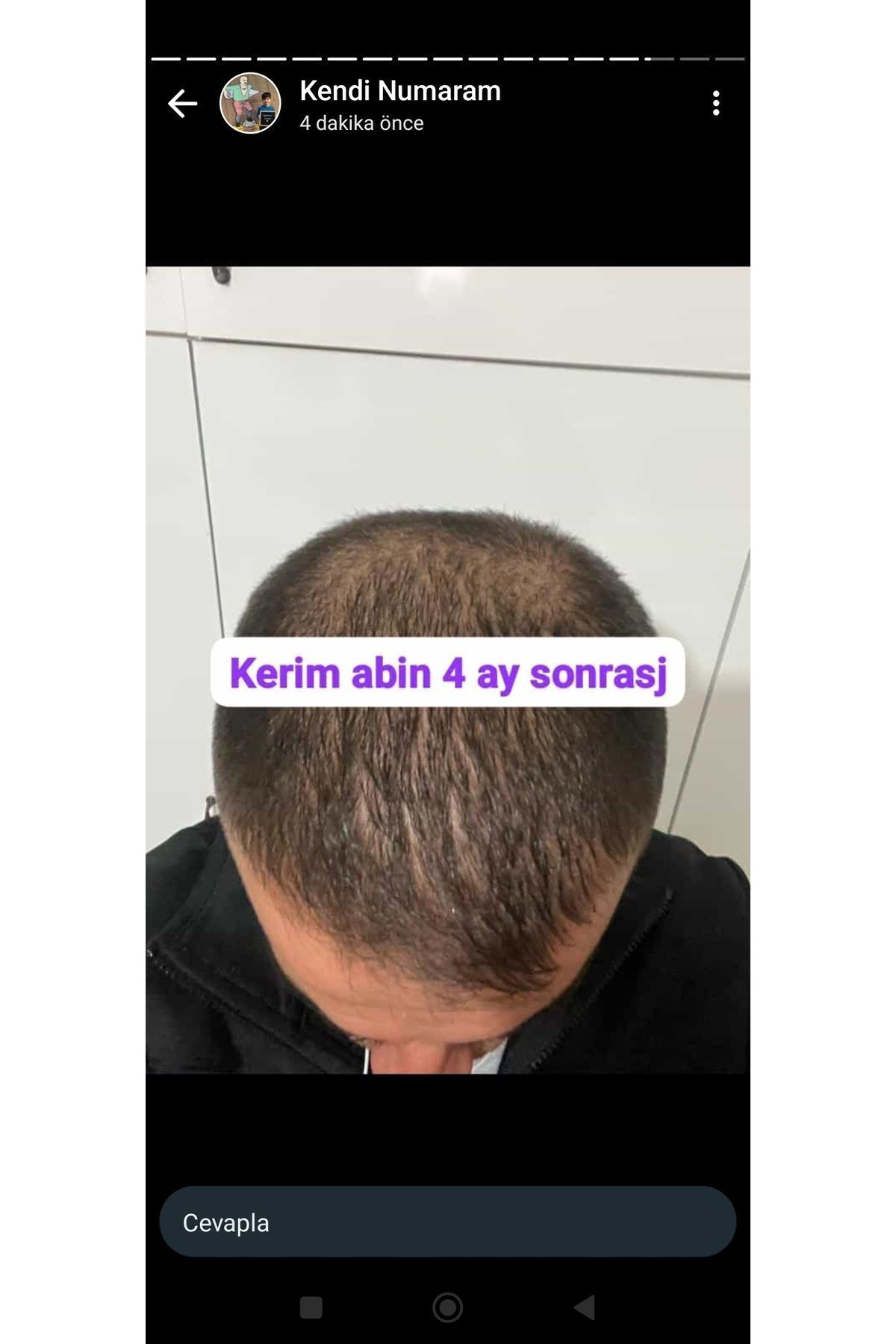 Sarı saç solusyonu — 5011380547 — تصویر 7 از 8