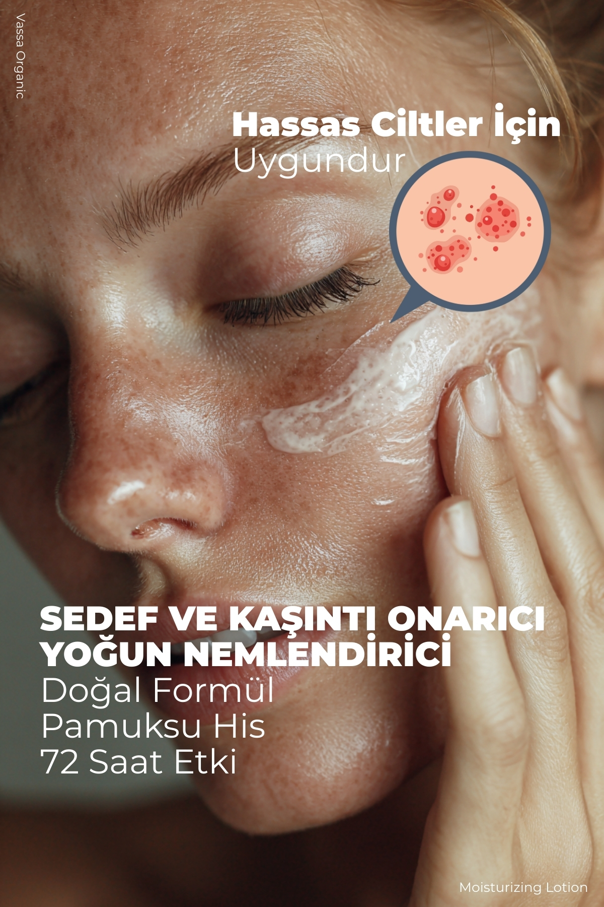 Kaşıntı Karşıtı, Pul Pul Dökülme Azaltıcı, Cilt Bakım Kremi - Yoğun Vücut Nemlendiricisi 100 ml — VASSA0021VBK — تصویر 5 از 7