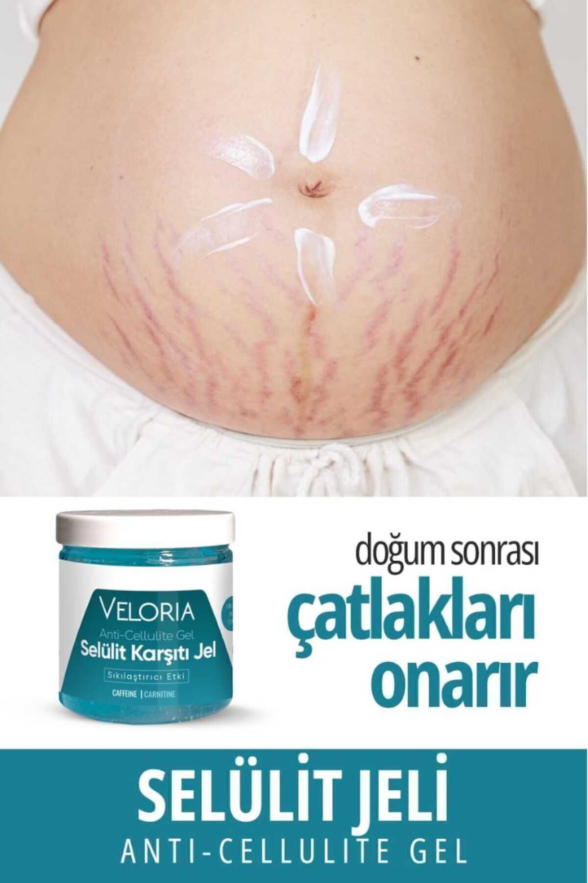 Veloria Cosmetics Selülit Ve Çatlak Giderici Leke karşıtı Vücut Şekillendirici Jel 250 ml — 2636328