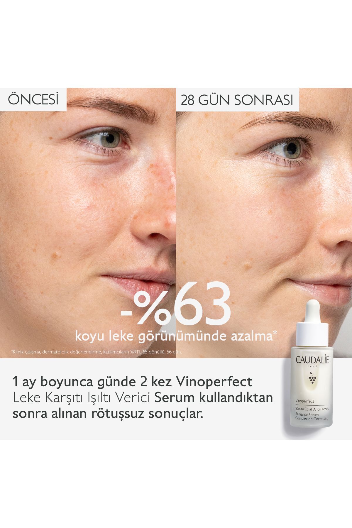 Vinoperfect Serum 30 ml — 324 — تصویر 4 از 6