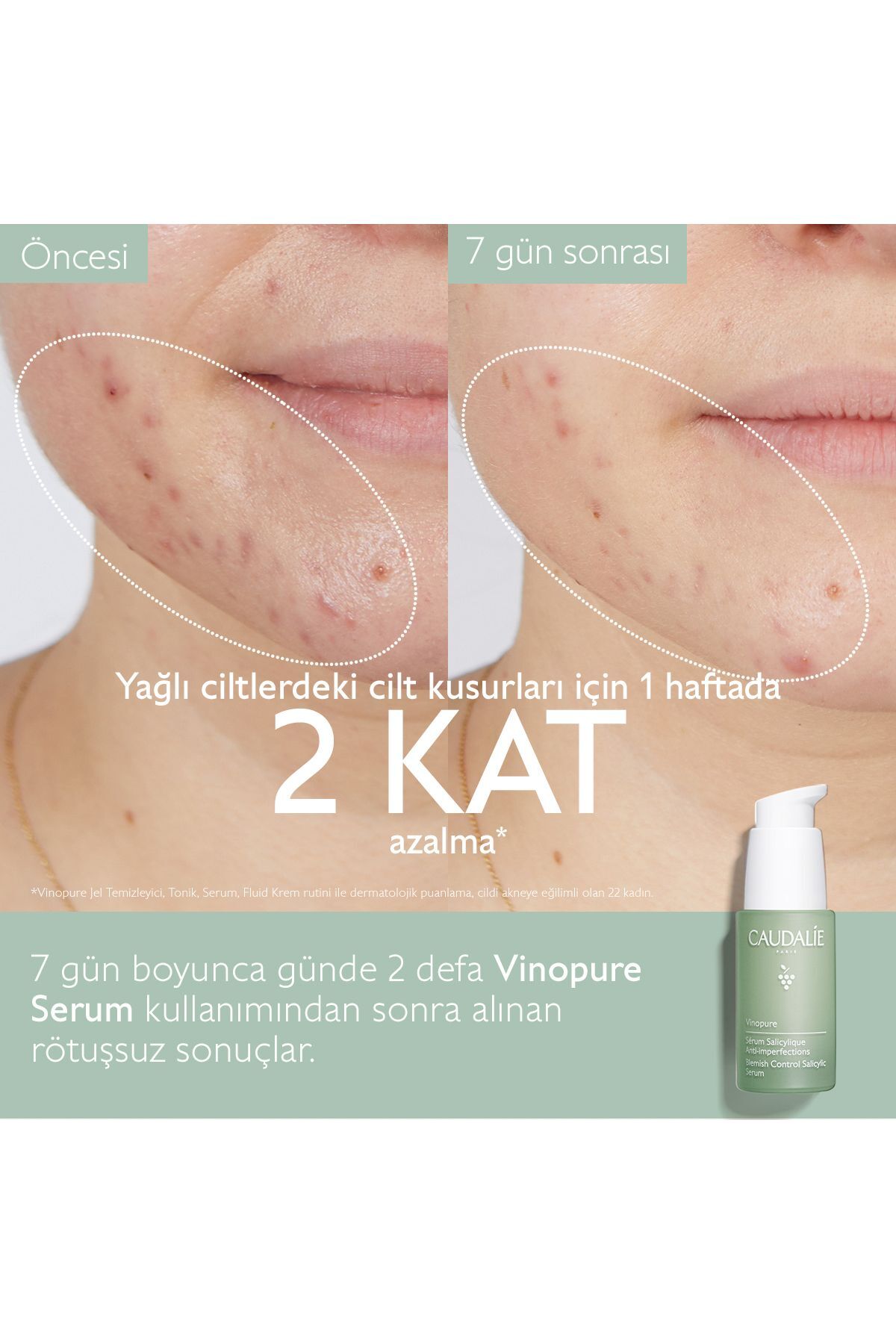 Vinopure Salisilik Serum 30 ml — 344 — تصویر 3 از 7