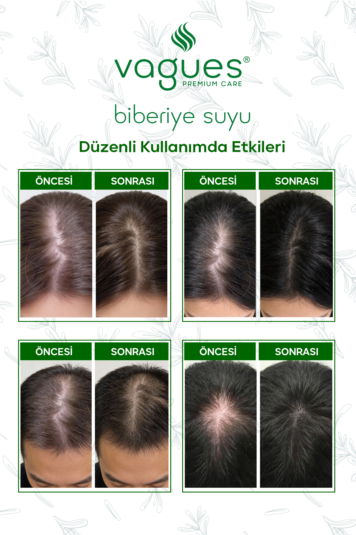 Biberiye Suyu Dökülme Karşıtı ve Saç Uzamasını Destekleyici Saç Toniği %100 Doğal ve Saf 100 ml — UNC-BS-100 — تصویر 3 از 4