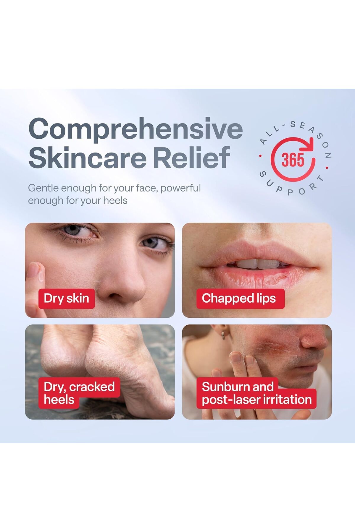 Retimax 1500 – A Vitamini (Retinol) Anti-Ageing & Nemlendirici Krem (30 g) — retimax1500 — تصویر 3 از 6