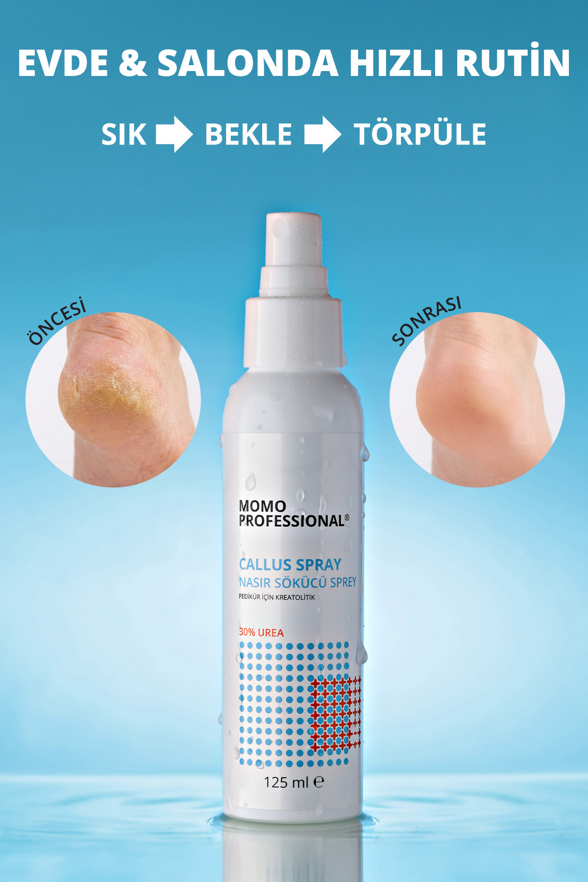 Callus Sprey, Nasır Sökücü Sprey, Pedikür Için Keratolitik Sprey, 125 ml — 1900107G07S10KR00 — تصویر 3 از 7