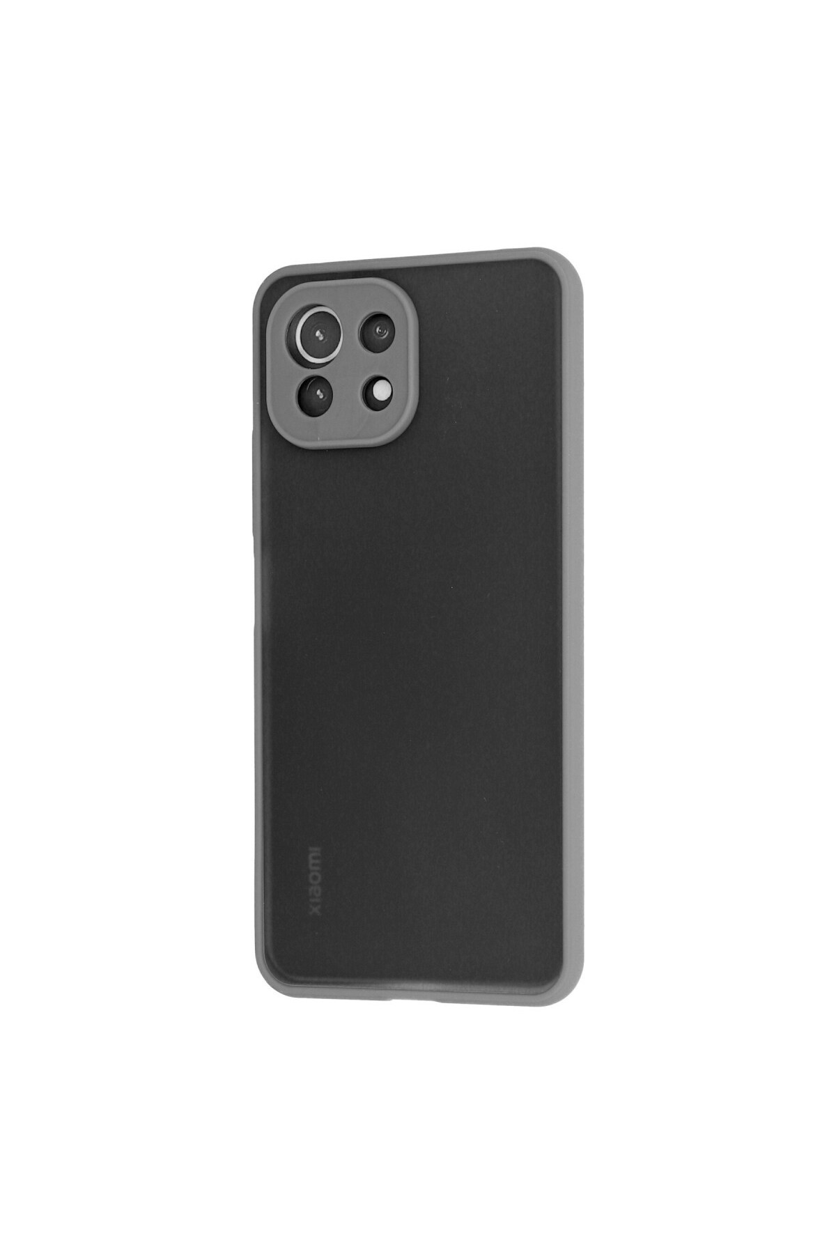 Xiaomi Mİ 11 Lite İçin Uyumlu Buzlu Tasarım Renkli Tuş Mat Tasarım Sararmaz Kılıf