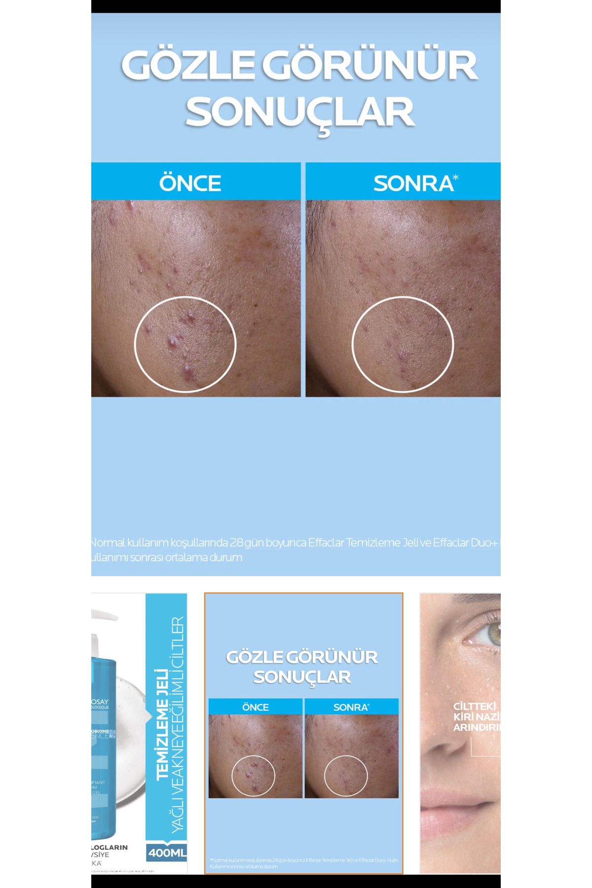 effaclar Yağlı ve Akneye meyilli ciltler için yüz temizleme jeli 400mlx — TYC54F26B90E47E39685F4300 — تصویر 2 از 5