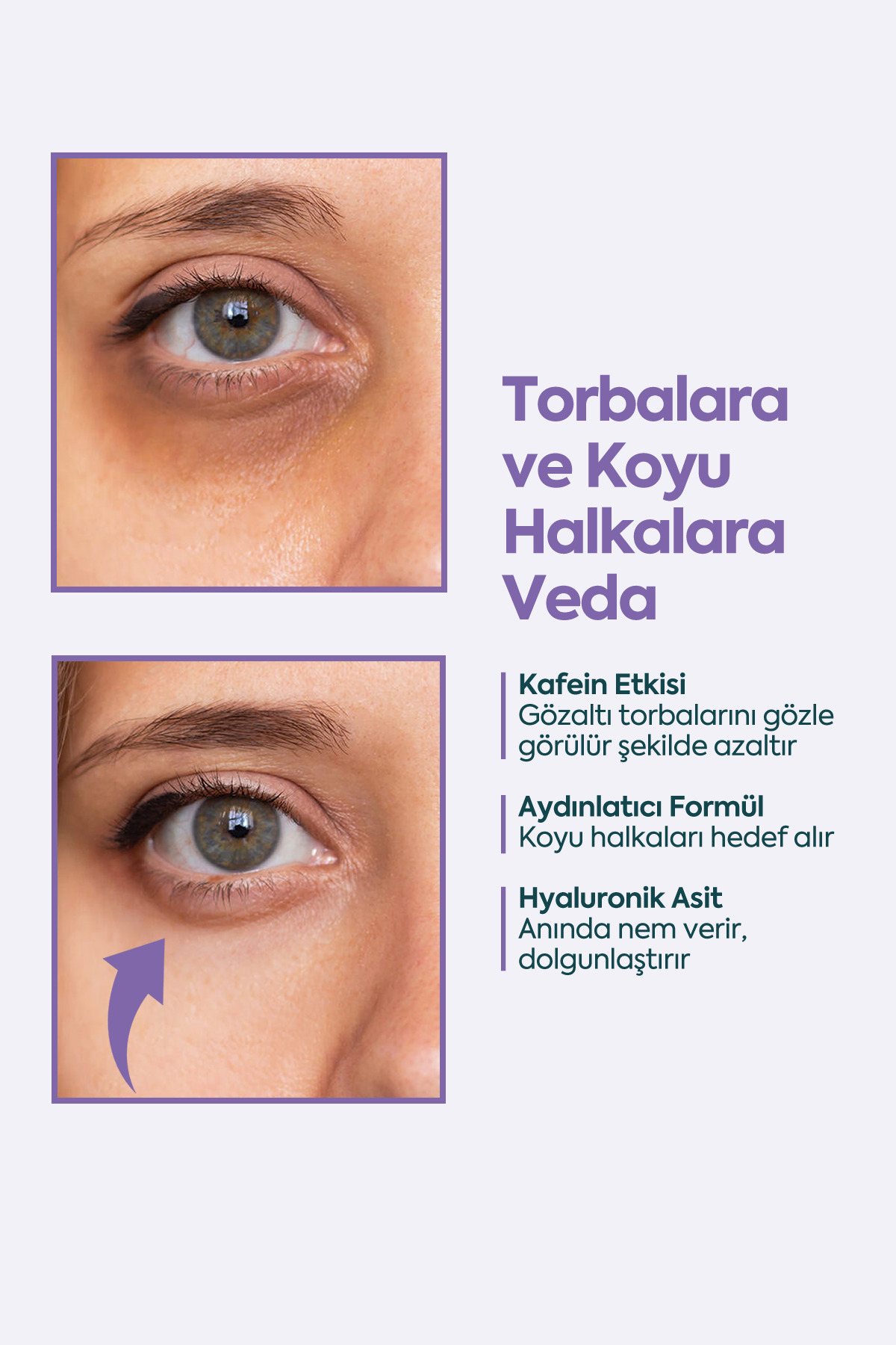 Face Up Skin Göz Altı Kremi, Göz Altı Morlukları Ve Göz Altı Nemlendirici 40ml — UnderEye Cream 40 mL — تصویر 4 از 8