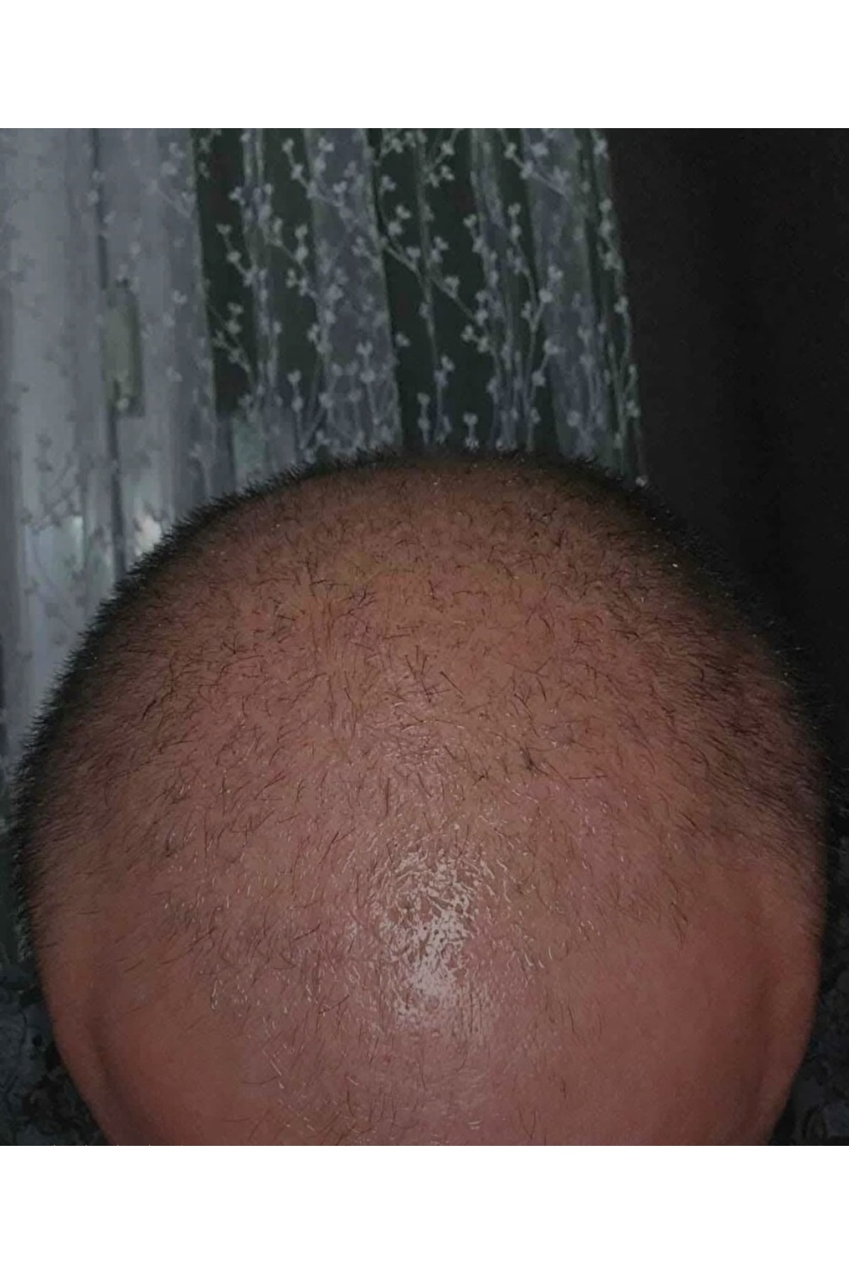 Mavi Serum — 682416350010 — تصویر 3 از 6