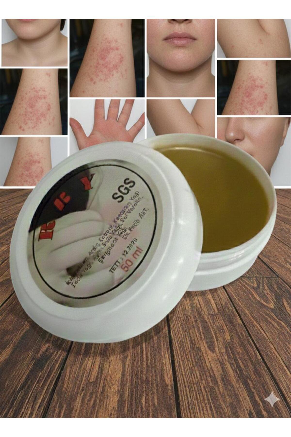 Katran Kremi 50mL Özel yapım Krem Özel Karışım Cilt Deri Kremi Kantaron aynı sefa ardıç katranlı — happy krem V442 — تصویر 3 از 8