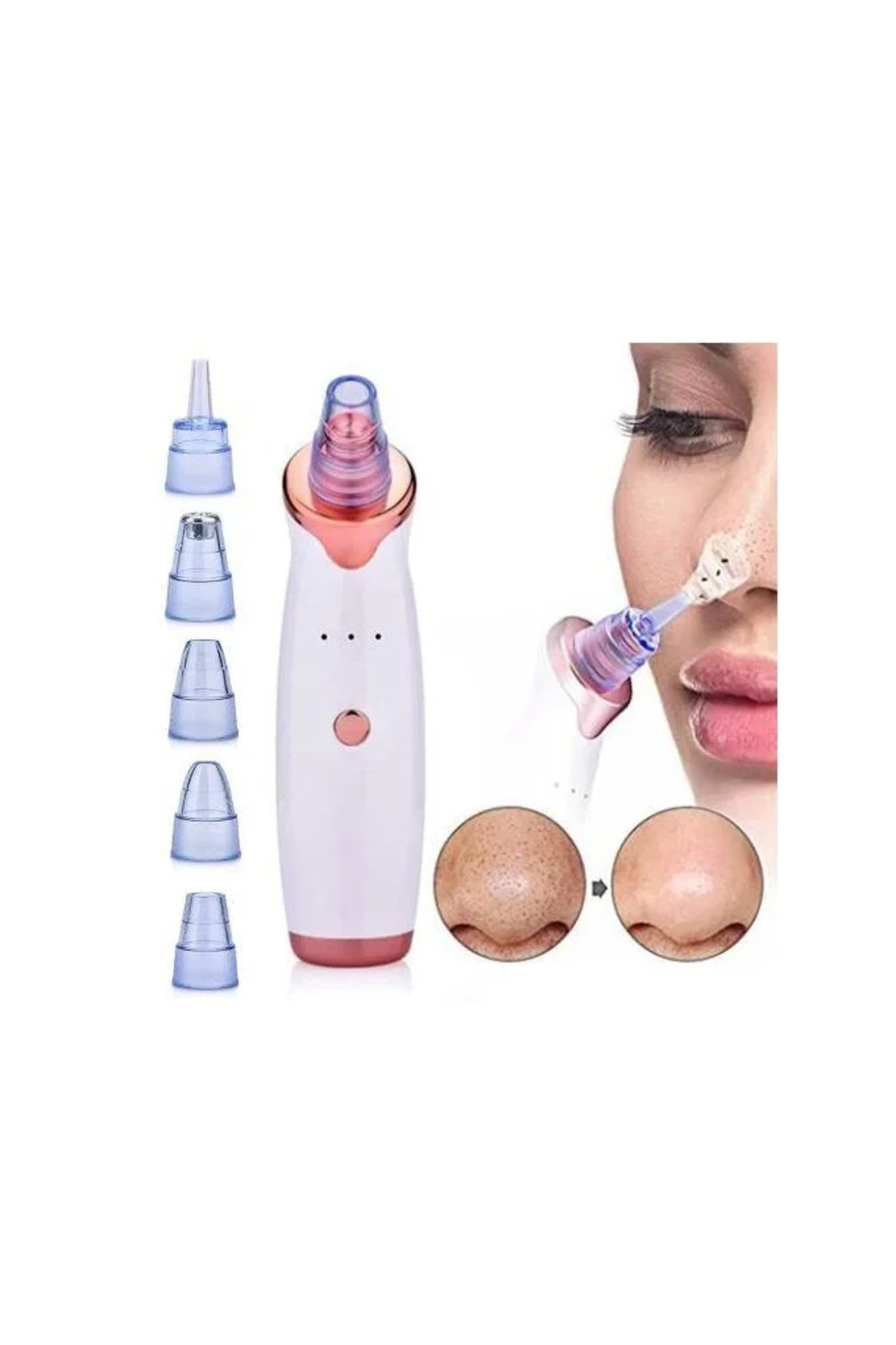 KaF KeF SHoPP VLK Şarjlı Siyah Nokta Temizleme Cihazı 5 Başlıklı (5047) VLK fotoğrafı 5 (önizleme)