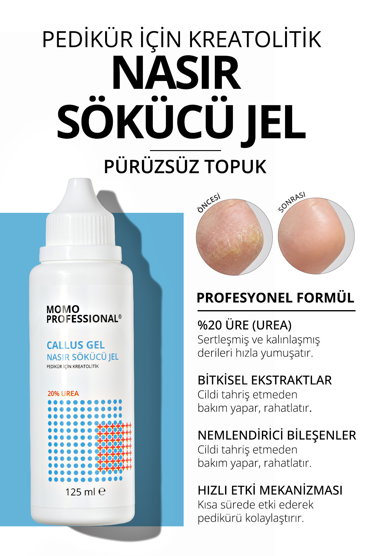 MOMO professional Callus Gel, Nasır Sökücü Jel, Pedikür Için Keratolitik Jel, 125 ml — 1900107G08S10KR00