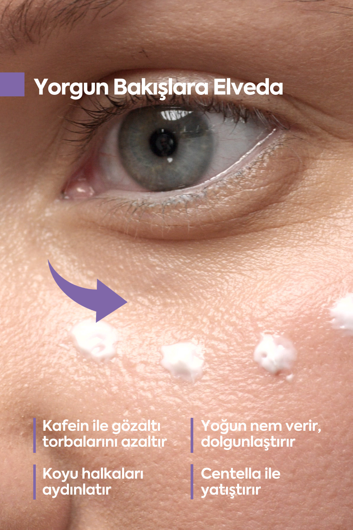 Face Up Skin Göz Altı Kremi, Göz Altı Morlukları Ve Göz Altı Nemlendirici 40ml — UnderEye Cream 40 mL — تصویر 3 از 8