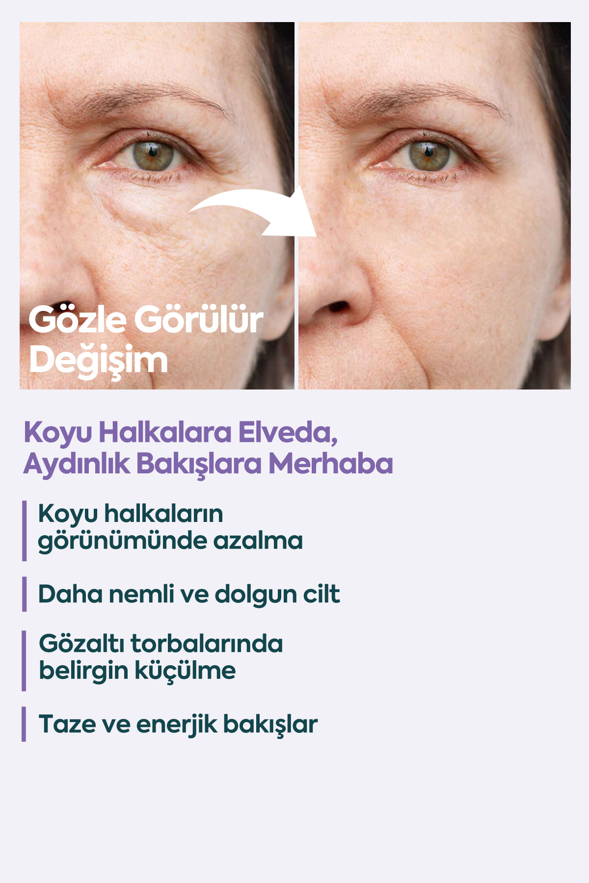 Face Up Skin Göz Altı Kremi, Göz Altı Morlukları Ve Göz Altı Nemlendirici 40ml — UnderEye Cream 40 mL — تصویر 5 از 8