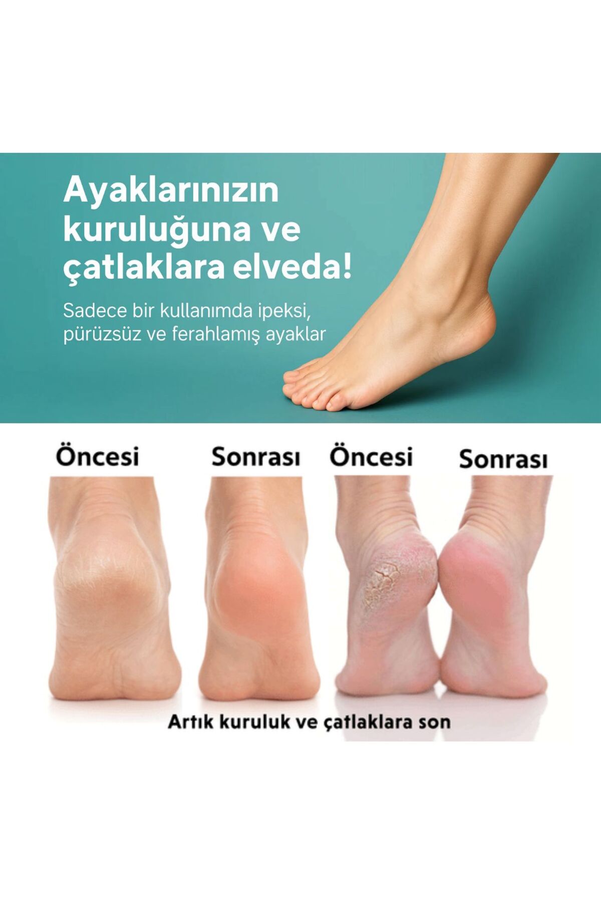 Onarıcı Ayak ve Topuk Çatlak Kremi 200 ML — ÇATLKRM200 — تصویر 3 از 3