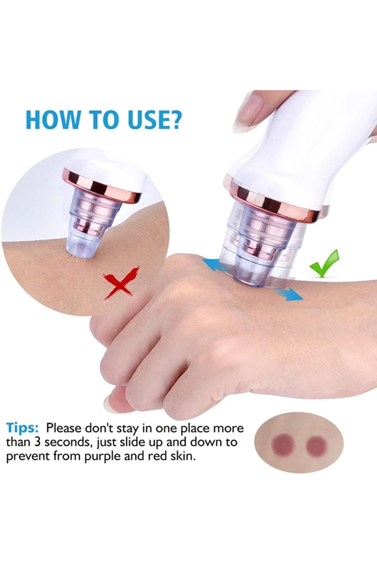 KaF KeF SHoPP VLK Şarjlı Siyah Nokta Temizleme Cihazı 5 Başlıklı (5047) VLK fotoğrafı 3 (önizleme)