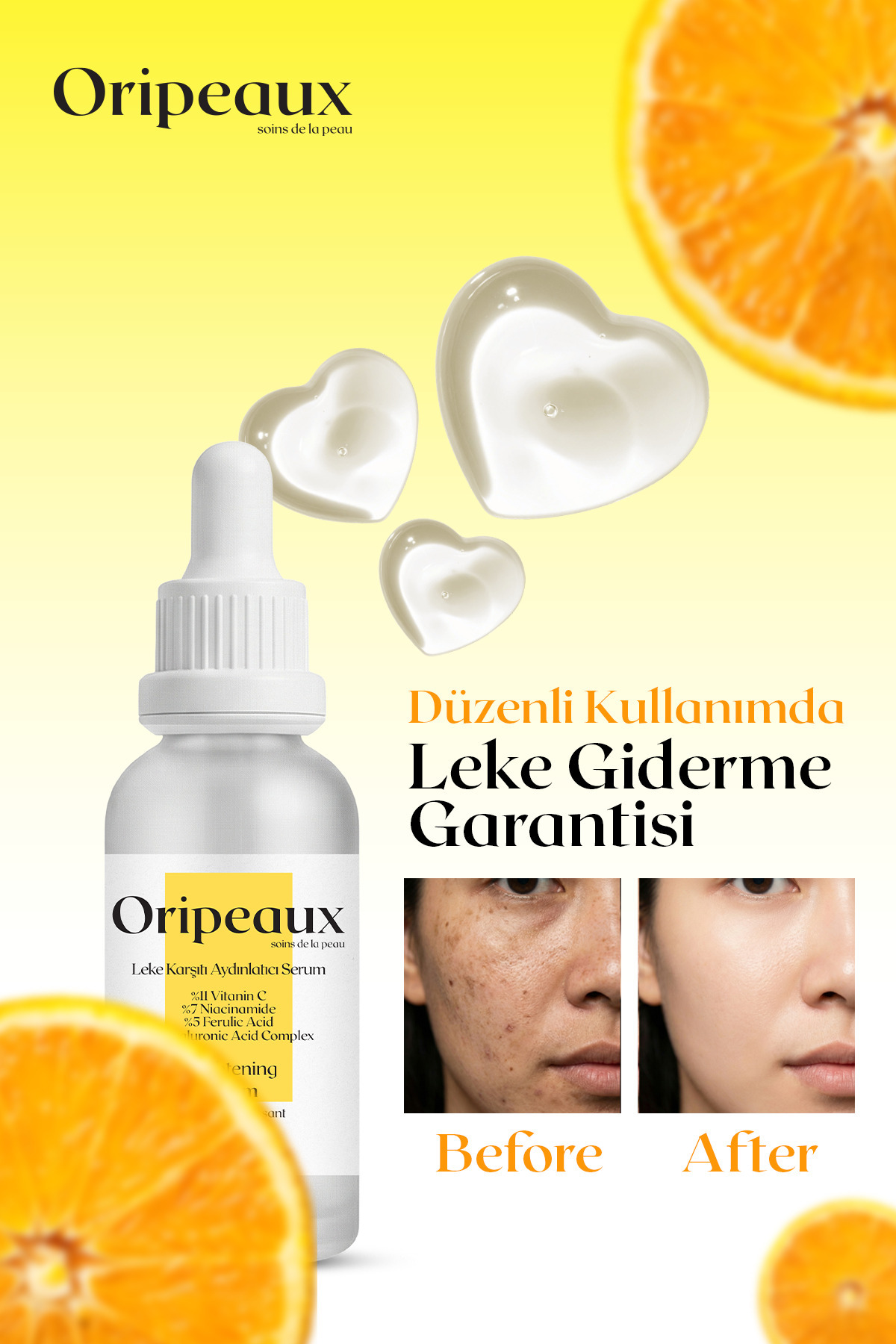 Leke Karşıtı Aydınlatıcı C Vitamini Cilt Serumu 30 ml (%11Cvit. 7%Niac. 5%Fer. Ac. 3%Hya.Acid.) — TYC1JTT7BN169503836795342 — تصویر 3 از 3