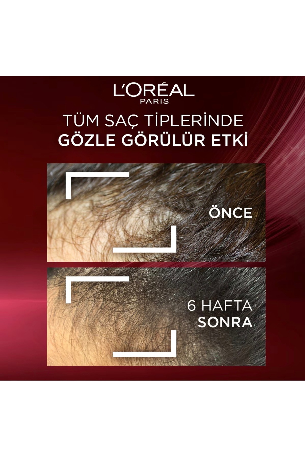 L’oreal Paris Elseve Komple Direnç Dökülmeye Karşıtı Saç Bakım Kremi