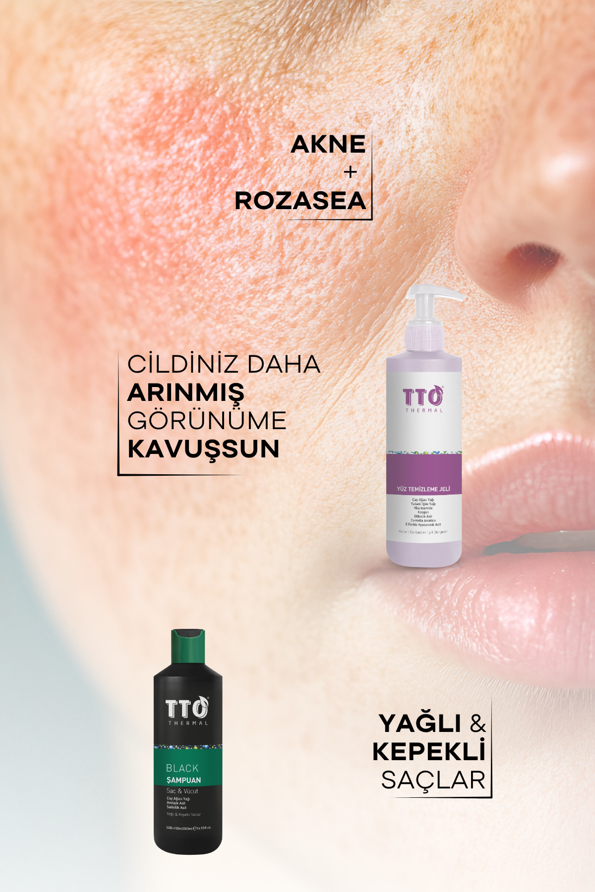 Cilt Bakım Seti - Kızarıklık Karşıtı Onarıcı Cilt Bakımı — YTJ-BLACKSAM — تصویر 2 از 5