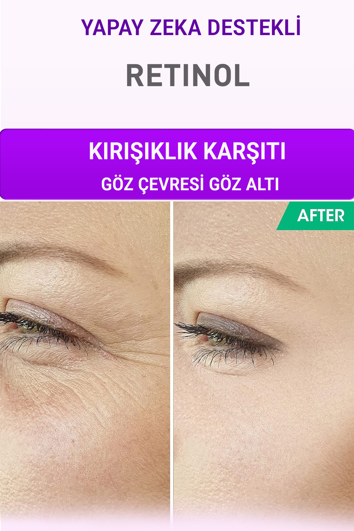 Retinol+Nemlendirici+C Vitamini Serum 3 lü Set Kırışıklık Alın Çizgisi Göz Çevresi — DA2601-A53 — تصویر 2 از 4