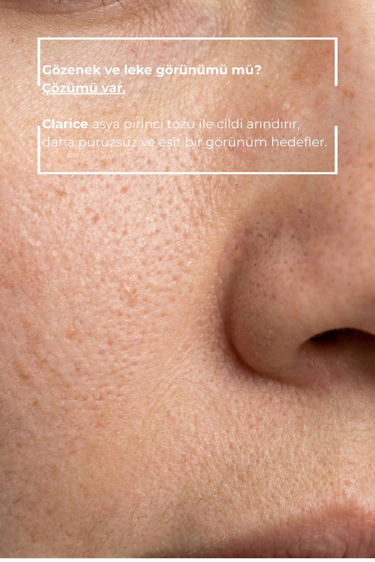 Pirinç Özlü Beyazlatıcı Leke Ve Gözenek Karşıtı Aydınlatıcı Peeling Maske 100 ml — FM01 — تصویر 2 از 7