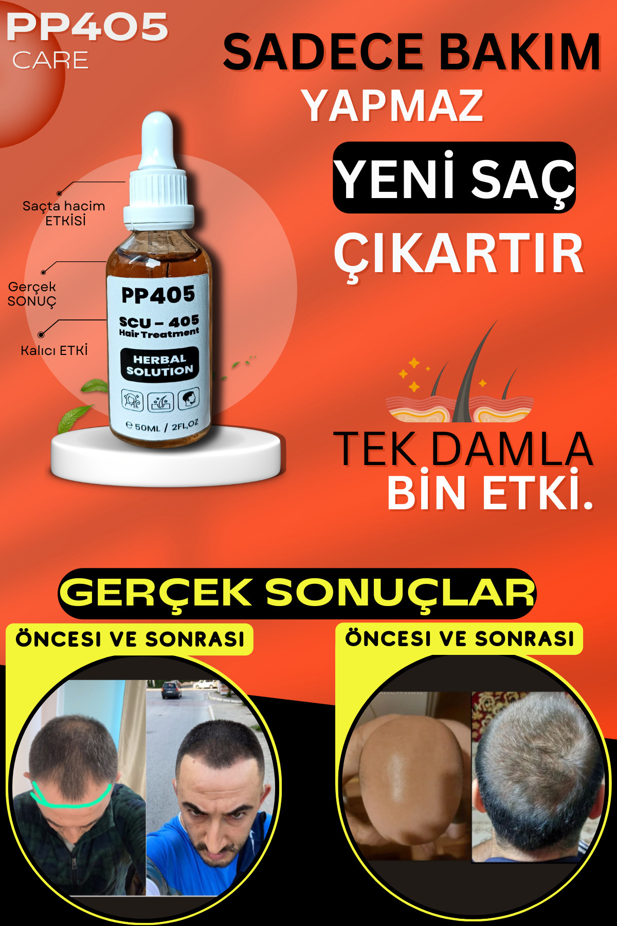Saç Çıkartıcı ve Gürleştirici Serum Kellik Karşıtı Kel Bölgeler İçin Hızlı Saç Uzatma - 2 Adet — 45256525352 — تصویر 6 از 8
