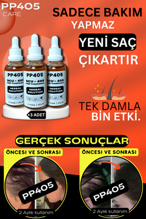 pp405 Profesyonel Saç Çıkartıcı Bakım Serumu - Kökü Oluşturucu ve Yoğun Gürle...