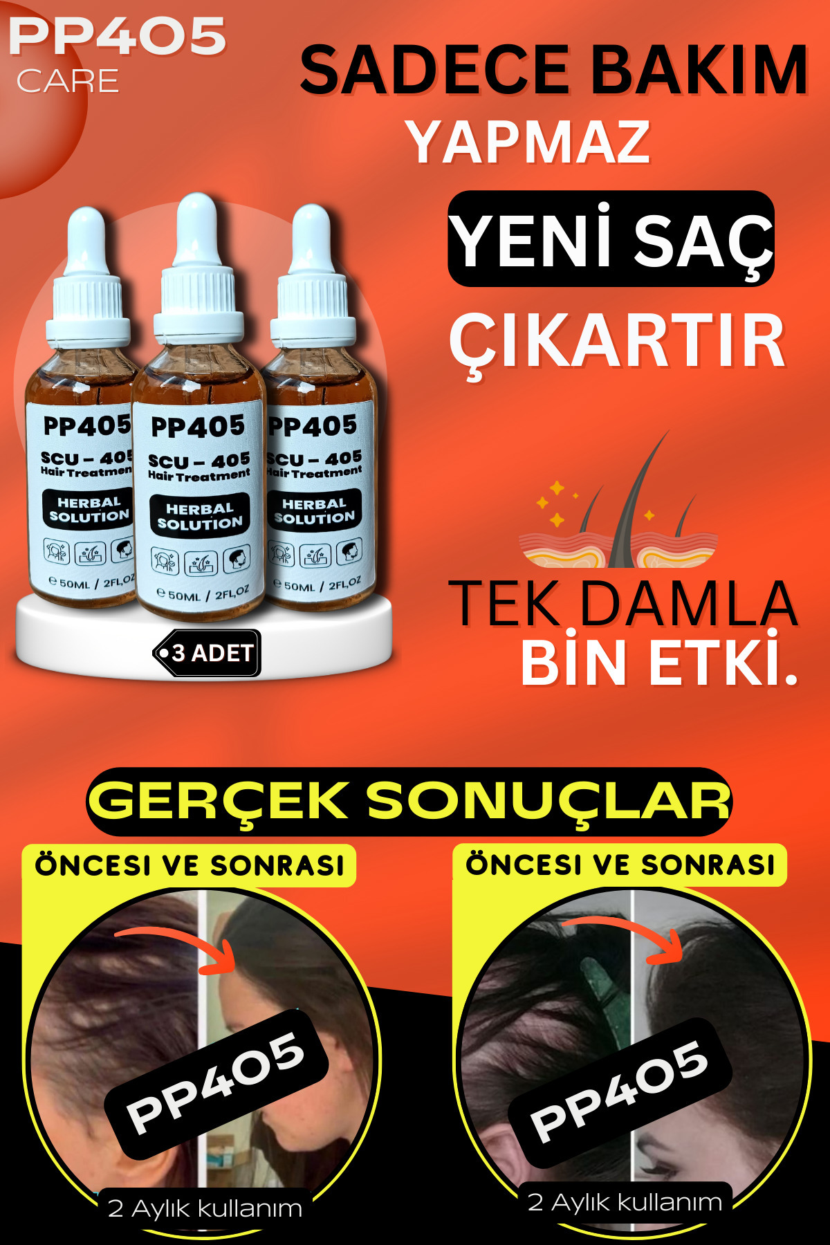 سرم رشد موی حرفهای - تقویت ریشه و ضخیمکننده قوی - بسته ۳ عددی — 625962542