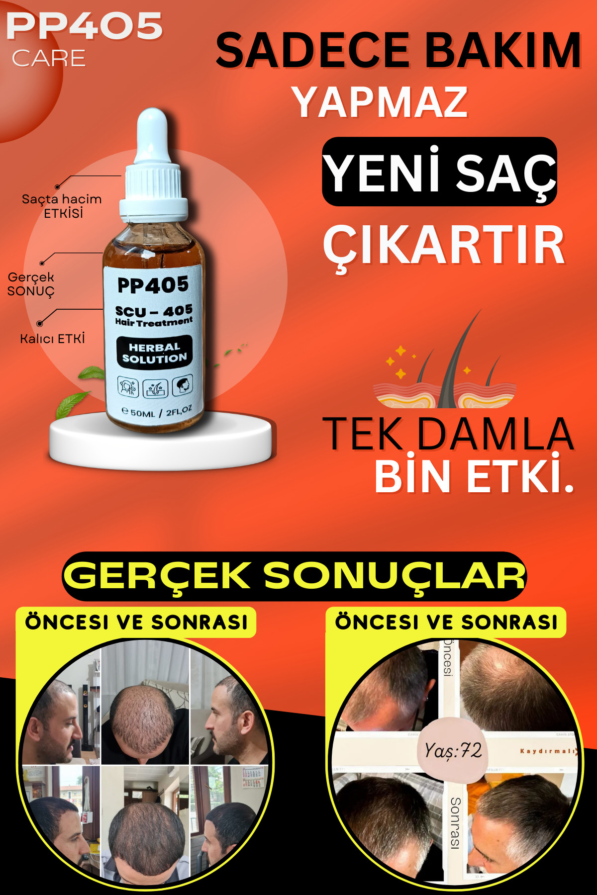 Saç Çıkartıcı ve Gürleştirici Serum Kellik Karşıtı Kel Bölgeler İçin Hızlı Saç Uzatma - 2 Adet — 45256525352 — تصویر 8 از 8