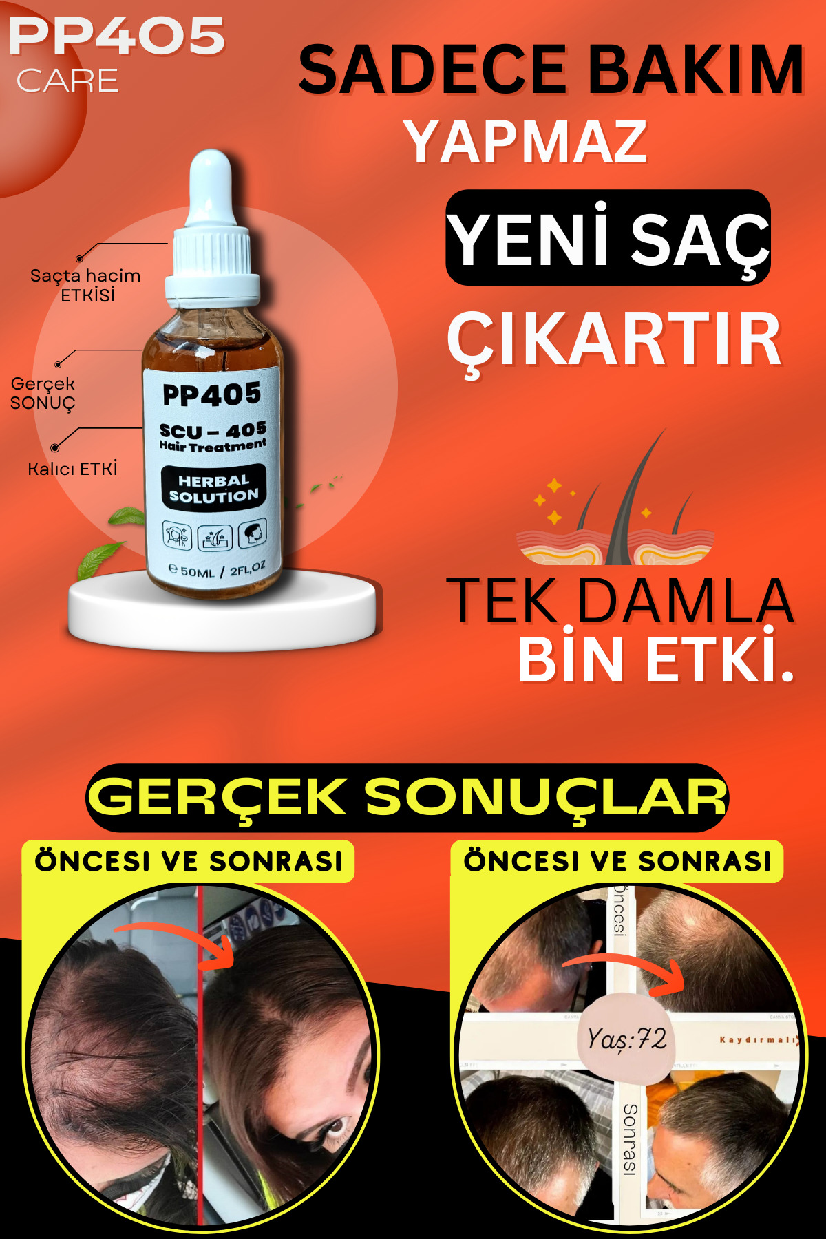 Saç Çıkartıcı ve Gürleştirici Serum Kellik Karşıtı Kel Bölgeler İçin Hızlı Saç Uzatma - 2 Adet — 45256525352 — تصویر 5 از 8