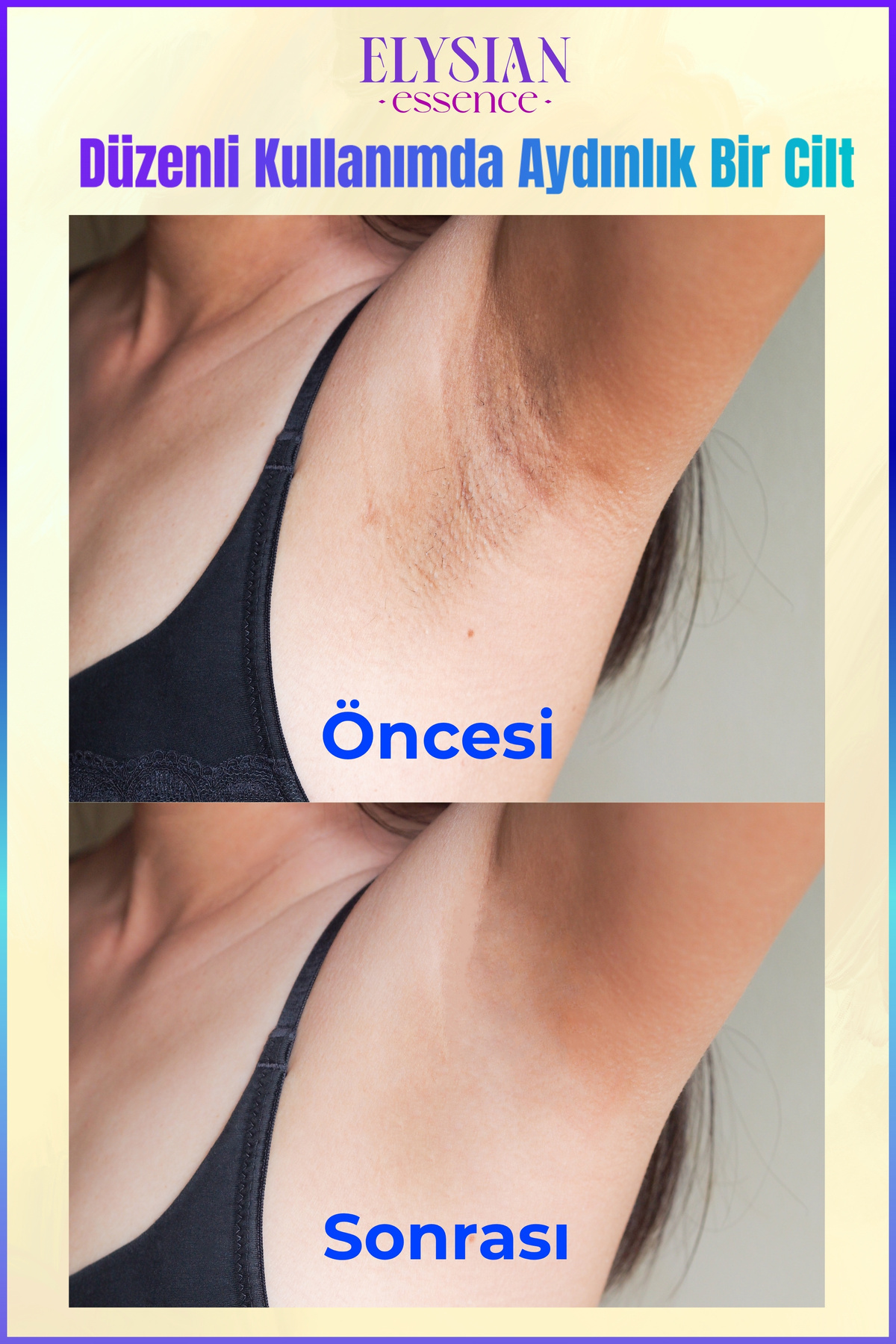 Cilt Beyazlatıcı | Kararma Giderici Krem - Genital Bölge, Koltuk Altı, Bikini Bölgesi ve Vücut 100ml — 4428 — تصویر 4 از 7