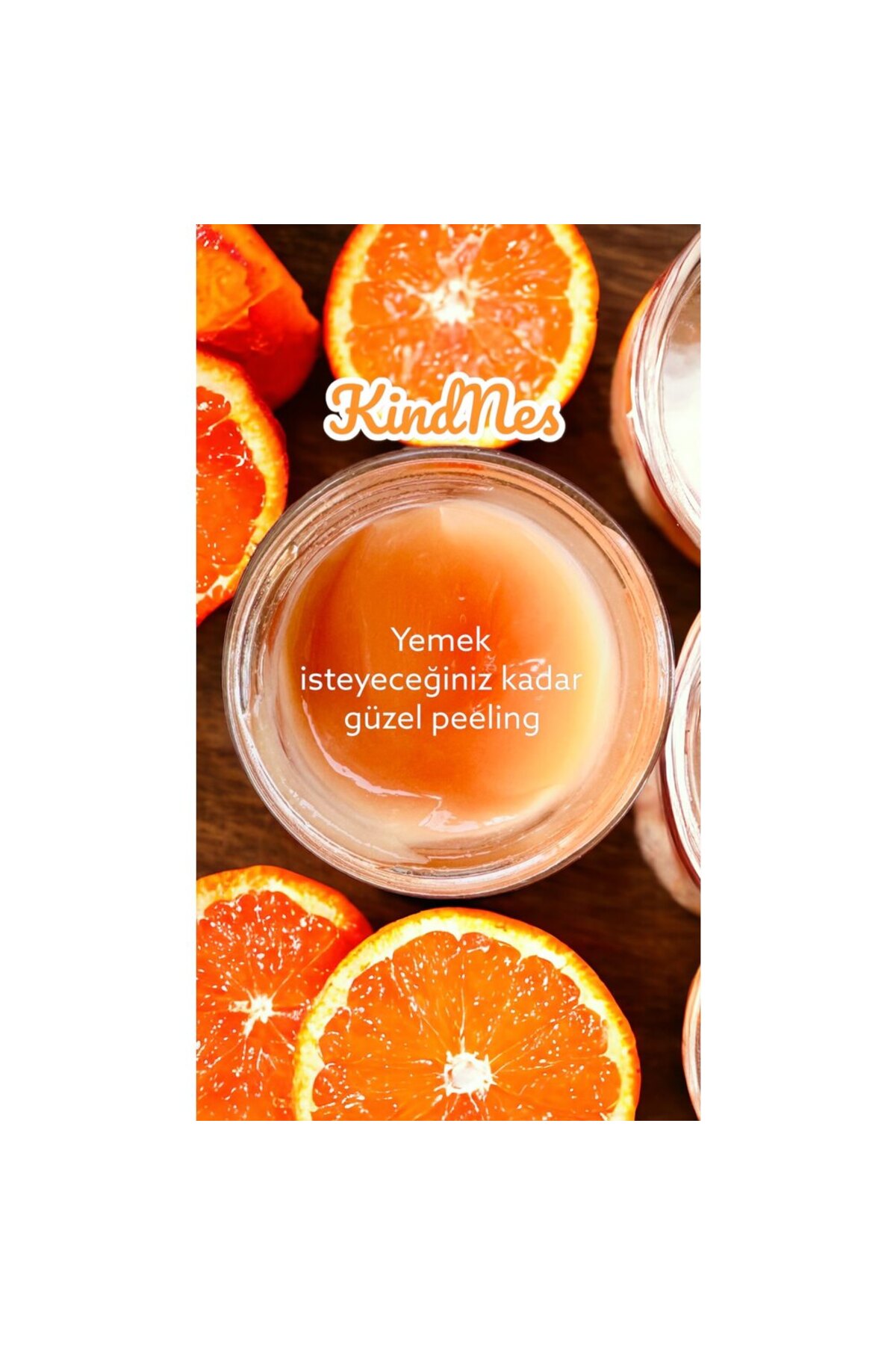 KindNes peeling — TYCHWI8YON169351306739866 — تصویر 5 از 5