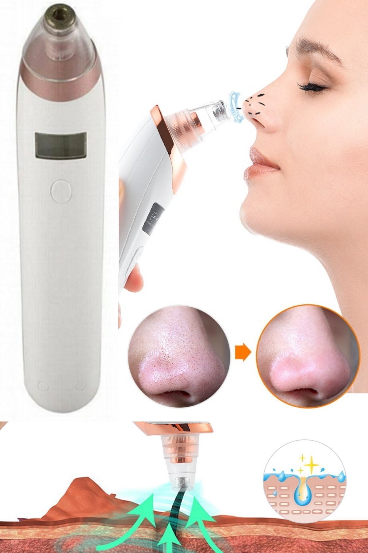 ابزار مراقبت از پوست یونیسکس پاک کننده جوش های سرسیاه، پاک کننده حرفه ای منافذ پوست، آکنه و جوش های سرسیاه — munico0000477 — تصویر 3 از 8