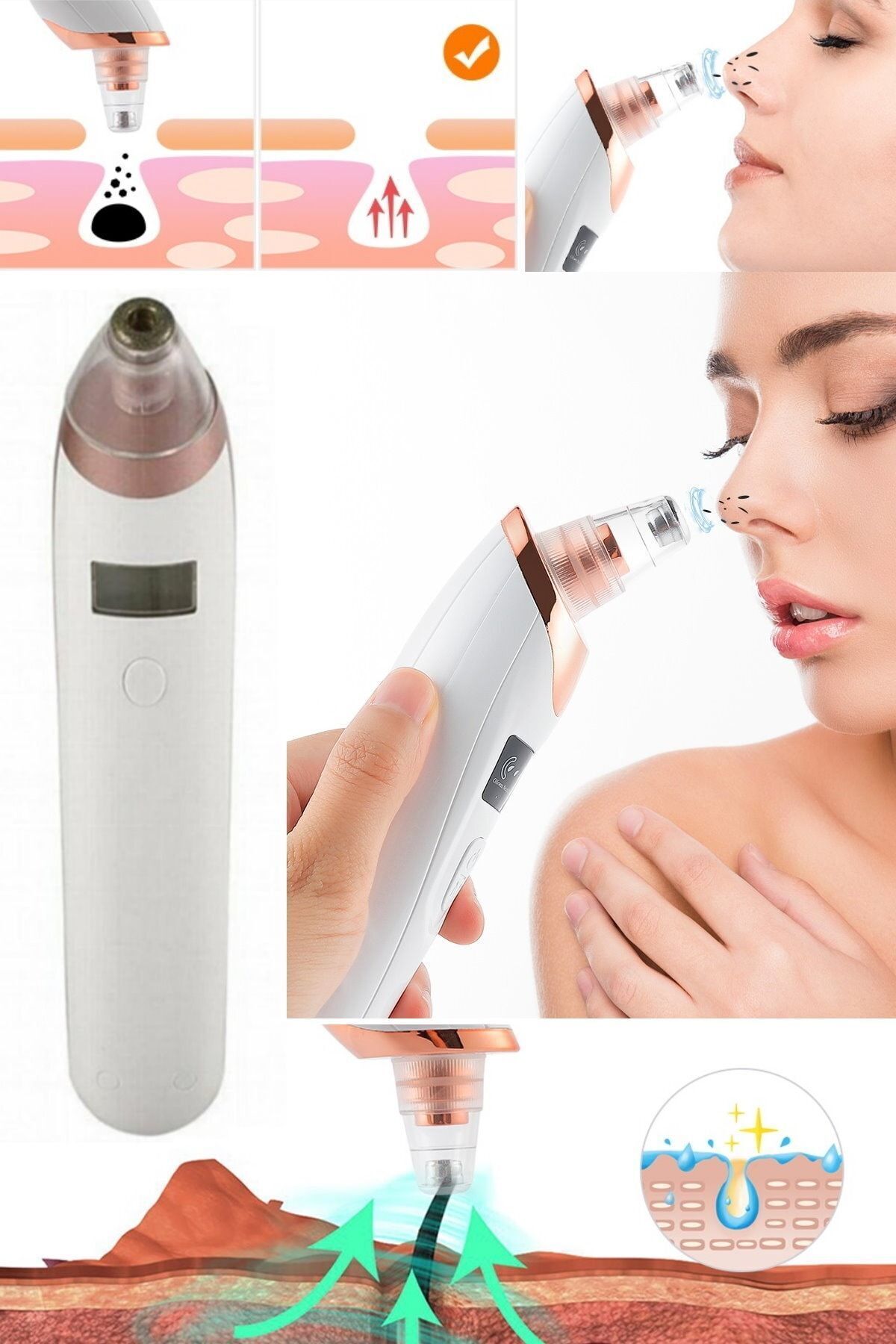 ابزار مراقبت از پوست یونیسکس پاک کننده جوش های سرسیاه، پاک کننده حرفه ای منافذ پوست، آکنه و جوش های سرسیاه — munico0000477 — تصویر 8 از 8