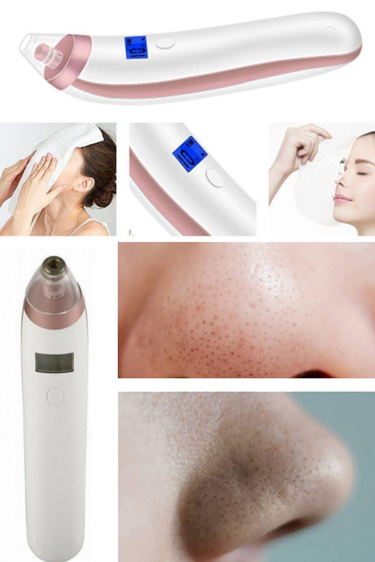 ابزار مراقبت از پوست یونیسکس پاک کننده جوش های سرسیاه، پاک کننده حرفه ای منافذ پوست، آکنه و جوش های سرسیاه — munico0000477 — تصویر 2 از 8