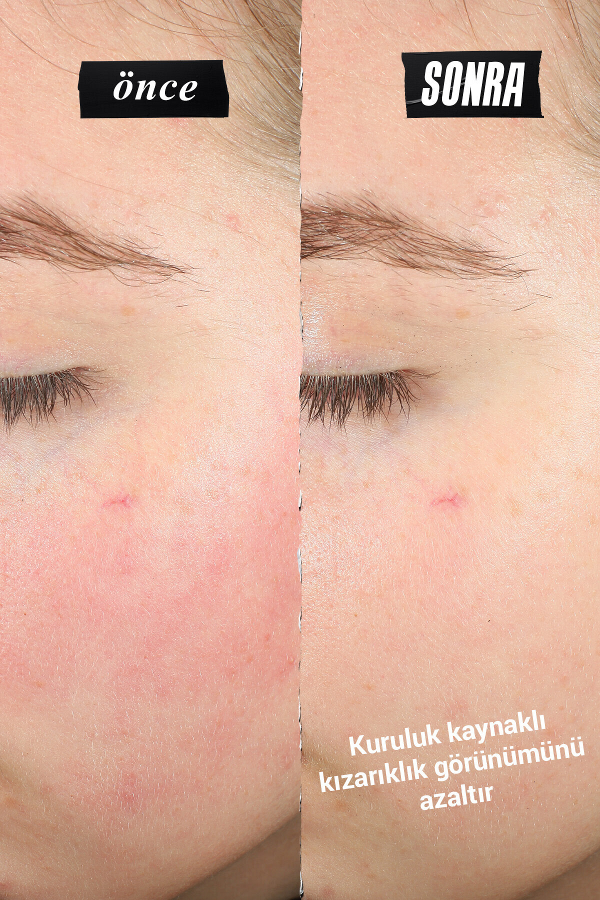 Ultra Facial Meltdown Cilt Bariyeri Onarıcı Nemlendirici Yüz Kremi 50 ml — S6244700 — تصویر 3 از 8