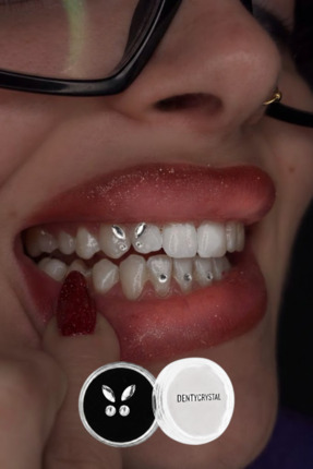 DENTYCRYSTAL Diş Pırlantası Kelebek Desenli (Avusturya Kristallerinden Oluştu...