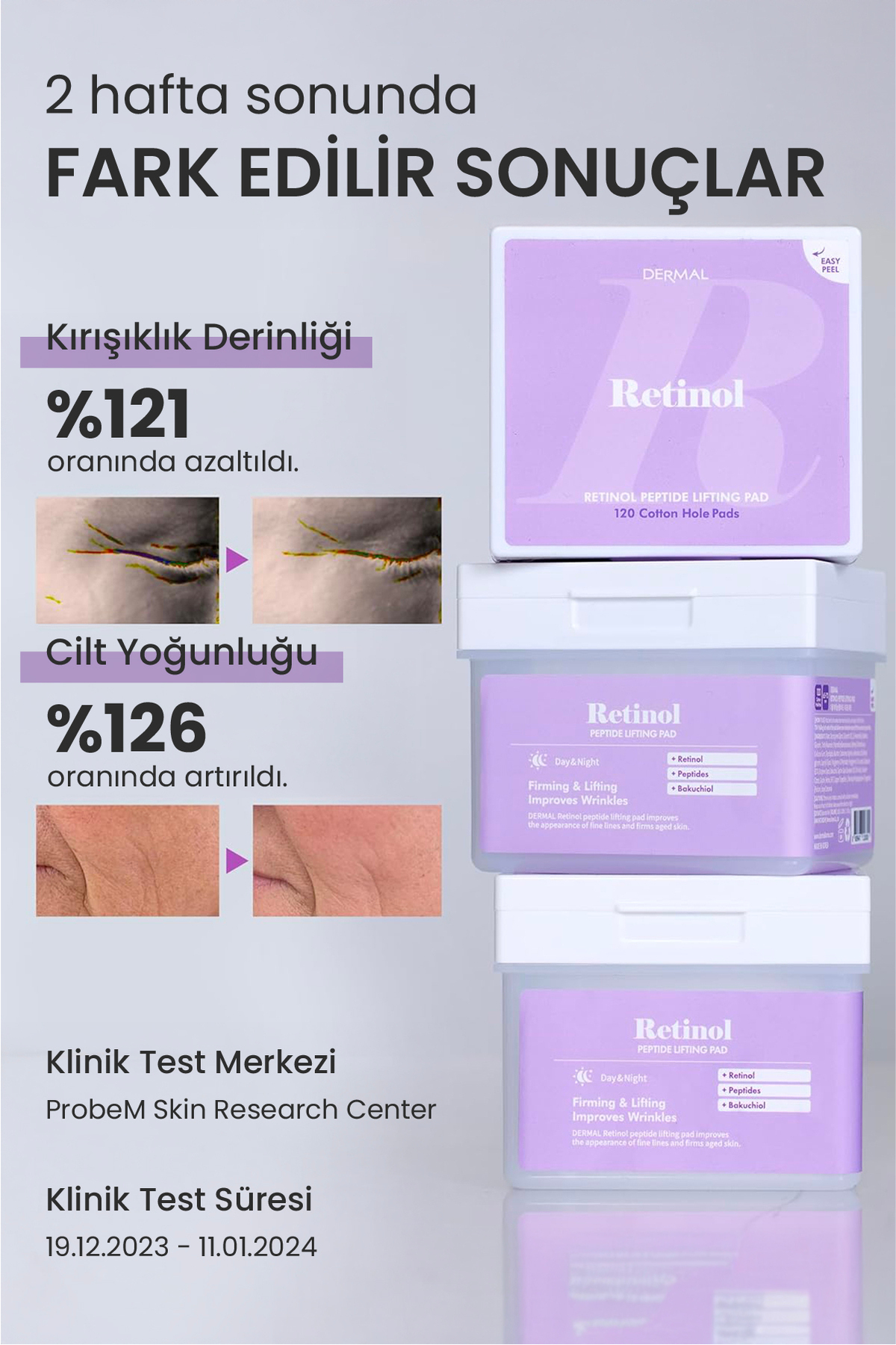 Retinol Peptit Kaldırma Pedi Yaşlanma Karşıtı Kore Tonik Ped 12 Adet — TYCQ7W33KN172830718295736 — تصویر 4 از 9