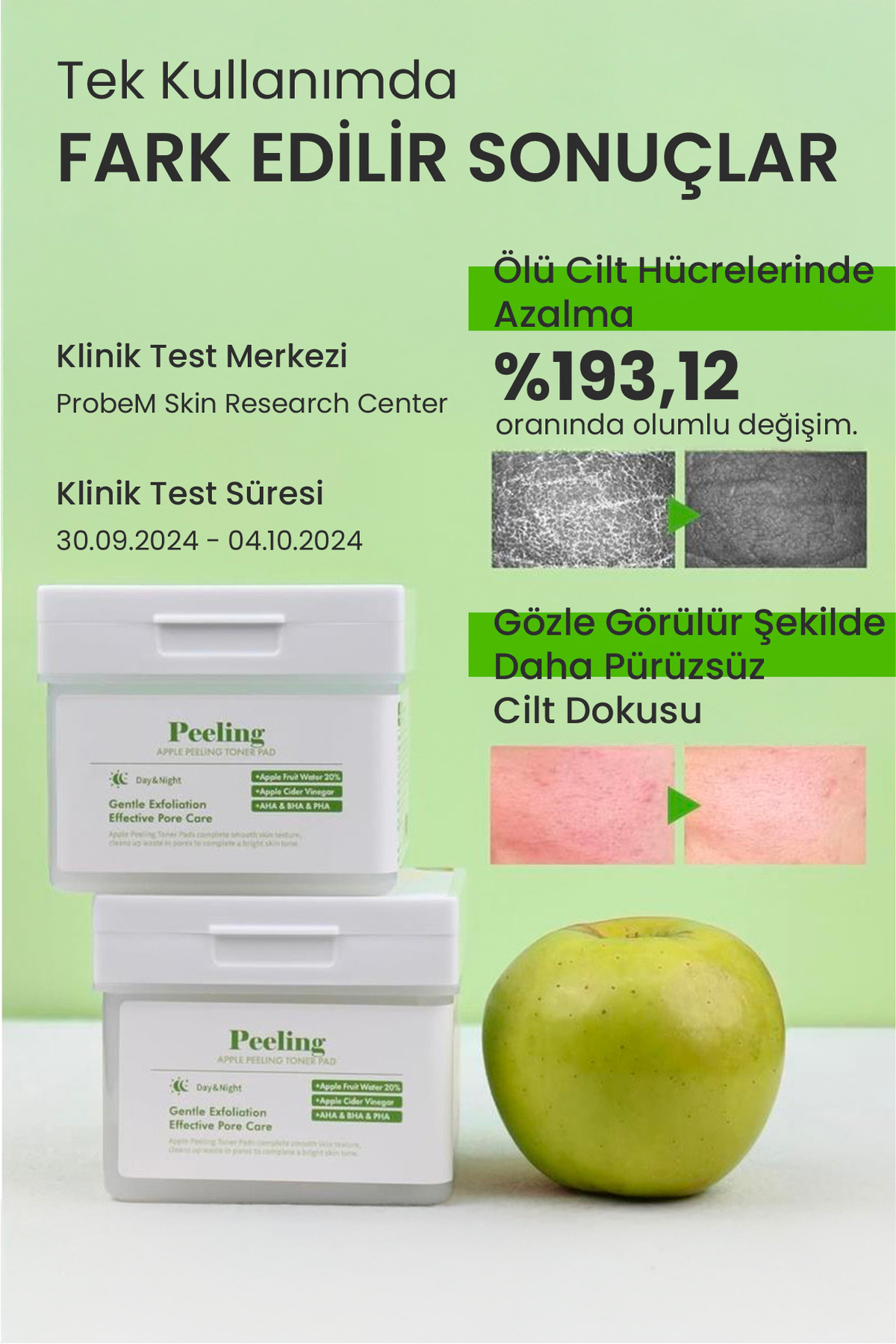 Elma Özlü Gözenek Temizleyici Aydınlatıcı Peeling Etkili Tonik Pedi 80 Adet Cilt Bakım Toner Pedi — DERMAL/PAD/009 — تصویر 3 از 7
