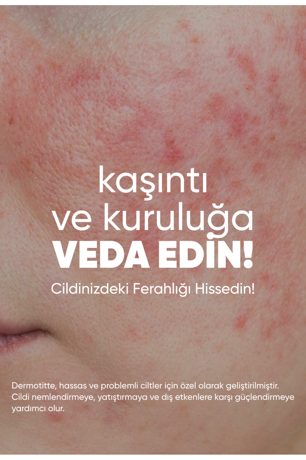 Dermotitte Sedefe Eğilimli Ciltler (Egzema) İçin Onarıcı ve yatıştırıcı Bakım Kremi 50 ml — dermotitte — تصویر 6 از 8